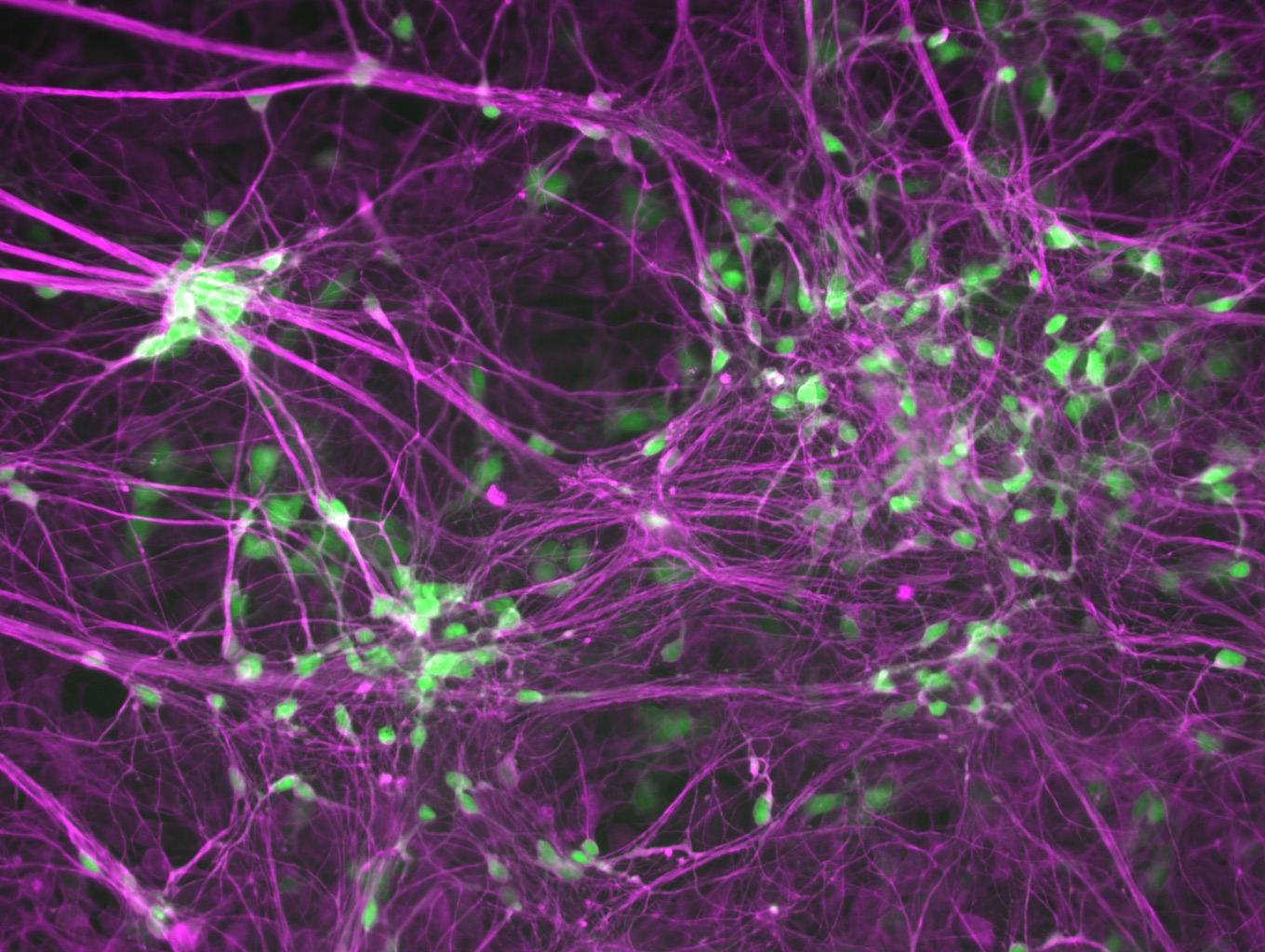 Human induced motor neurons that are labeled with a motor neuron marker HB9 in green and a neuron marker TUJ1 in purple.

CREDIT
Ichida Lab