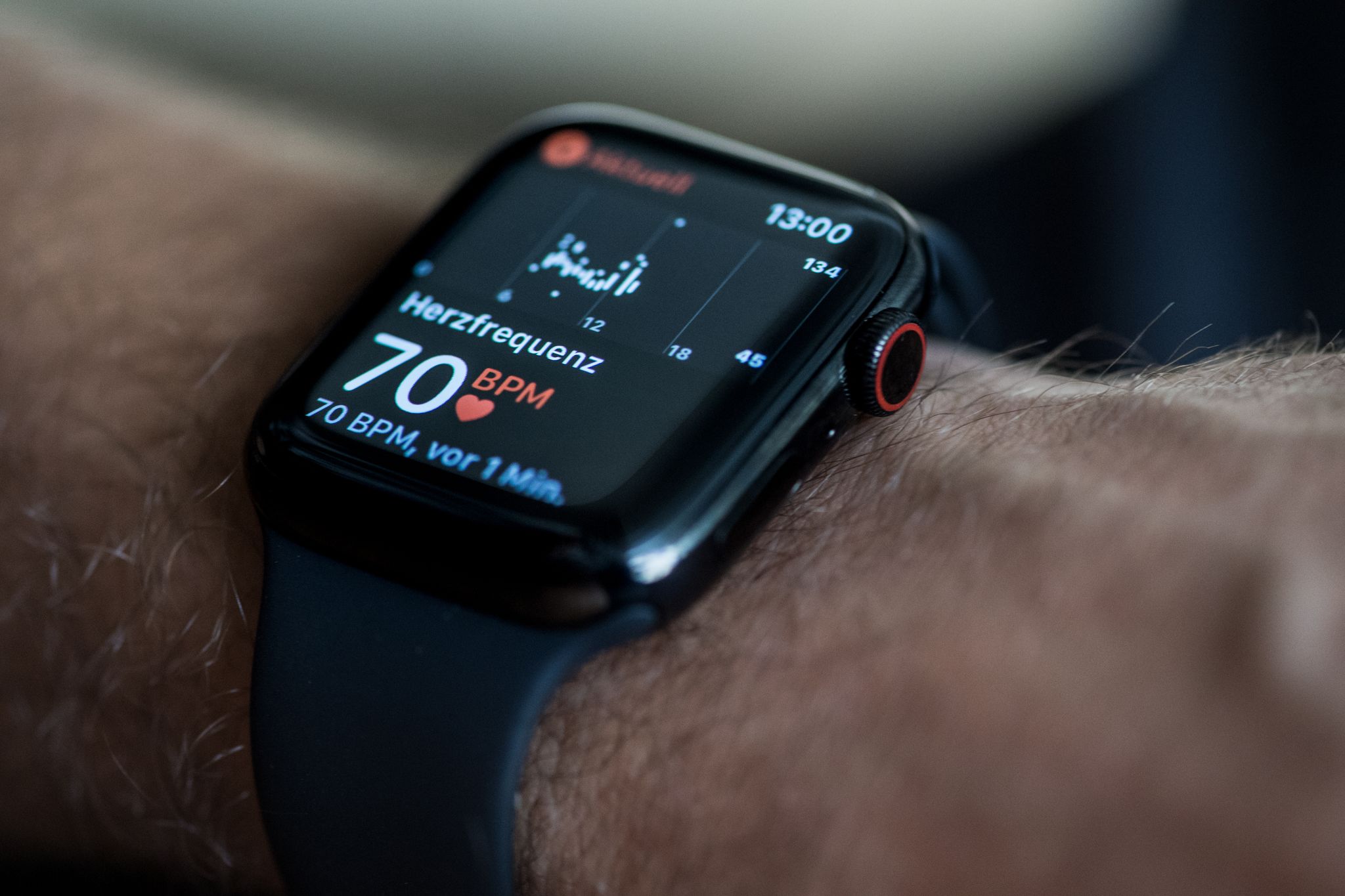 Puede un smartwatch detectar problemas cardíacos graves? - Infobae