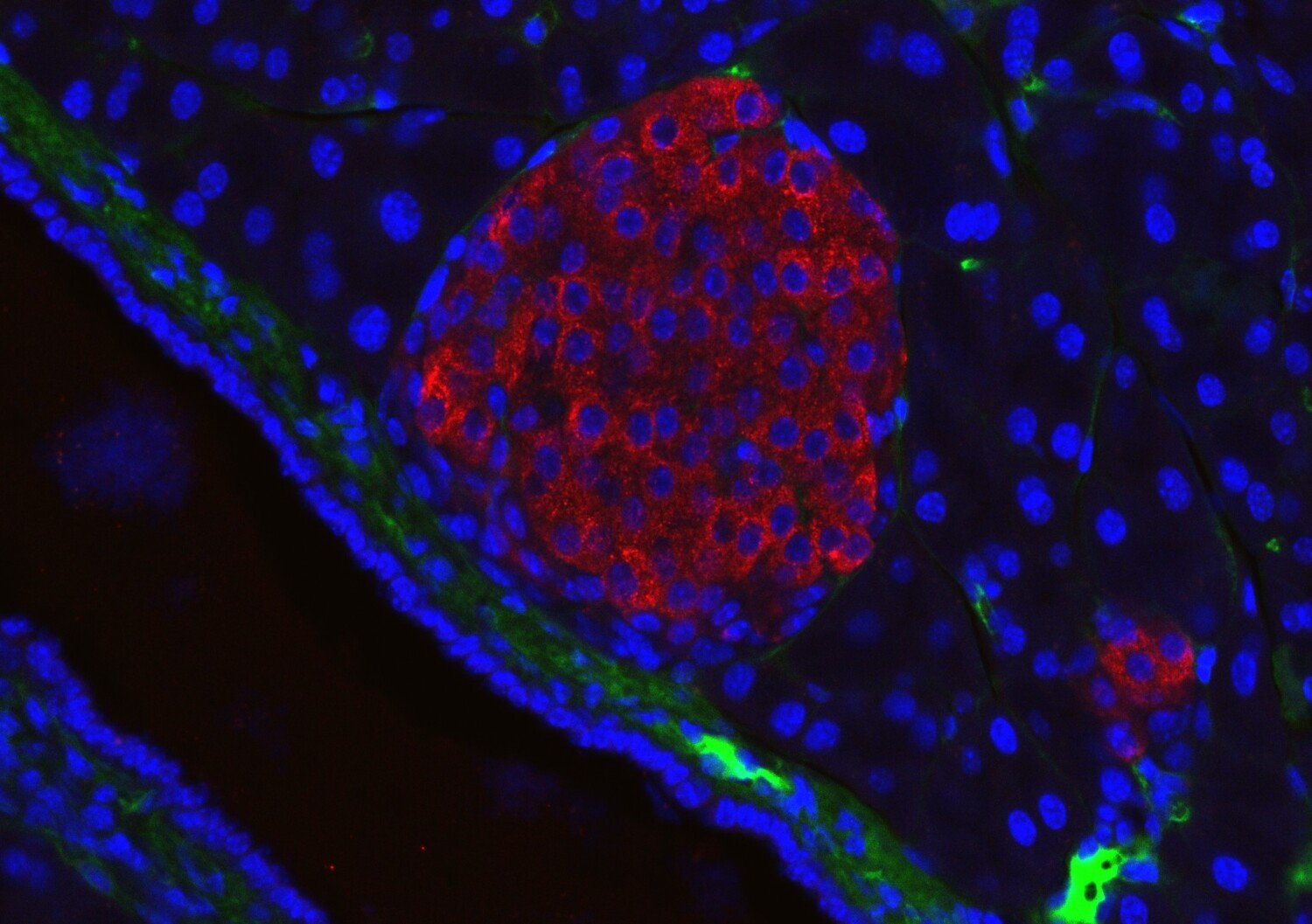 Un avance clave en diabetes: crean una técnica para observar células productoras de insulina en tiempo real