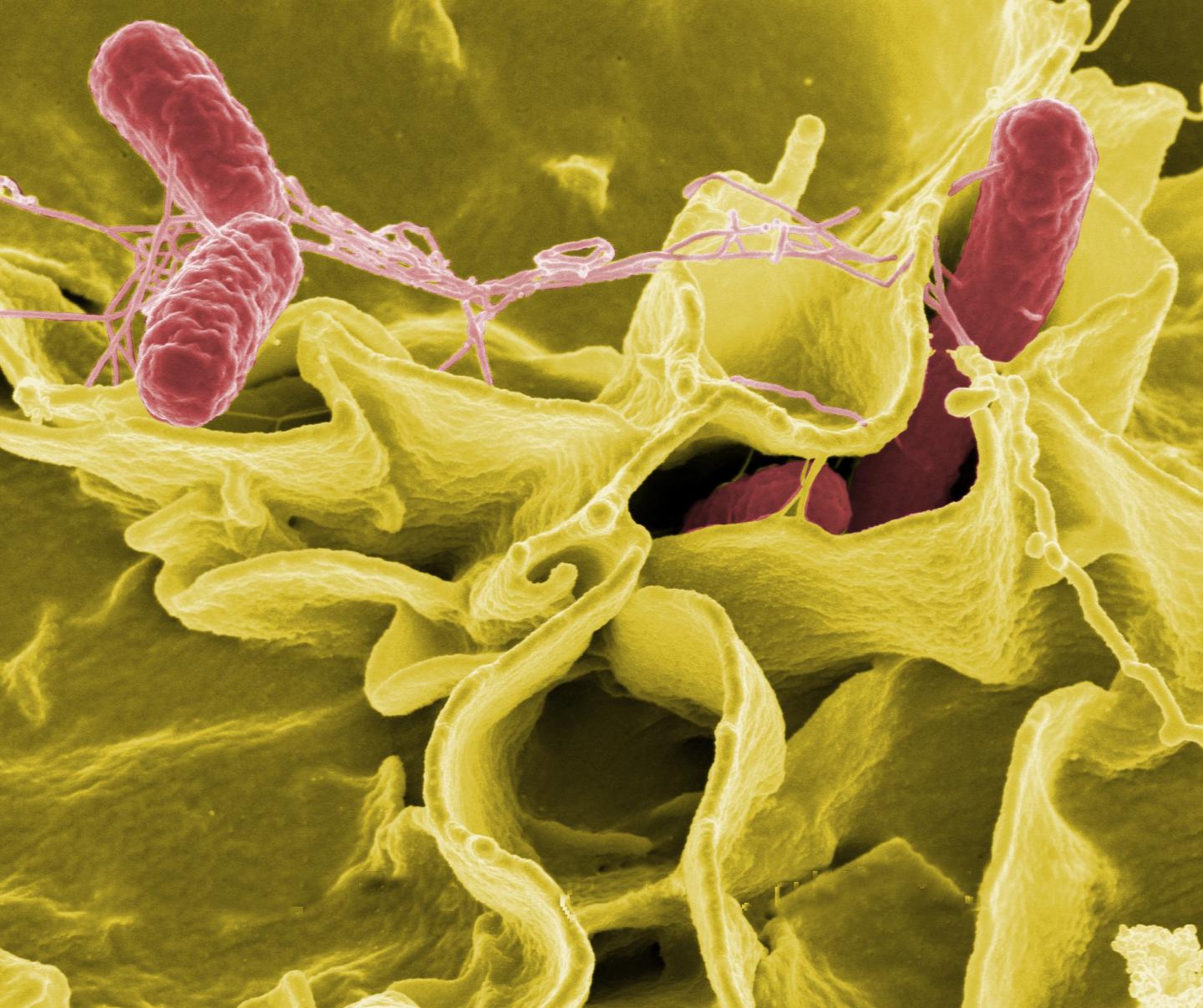 La bacteria Salmonella causa afección gastrointestinal (NIAID)