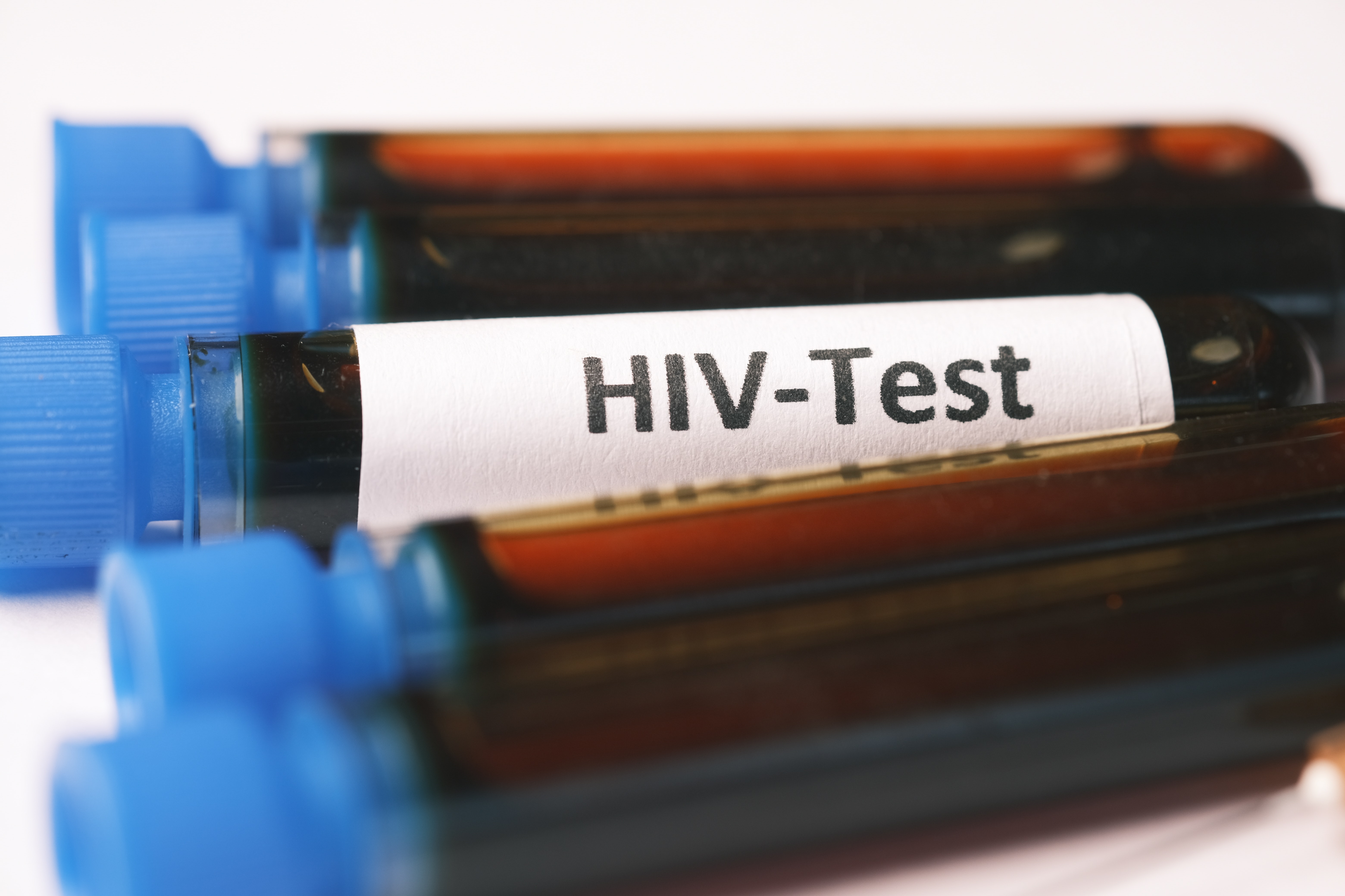 La AHF Argentina pidió no olvidar que todavía existe la pandemia del VIH/sida. Los test rápidos, que se realizarán durante la actividad, en el último tiempo ganaron importancia debido a su efectividad comparable con las pruebas convencionales, recordó (Pexels)