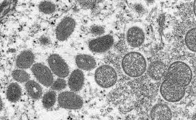 El virus de la viruela de los monos fue descripto por primera vez en monos de laboratorio en 1958/CDC