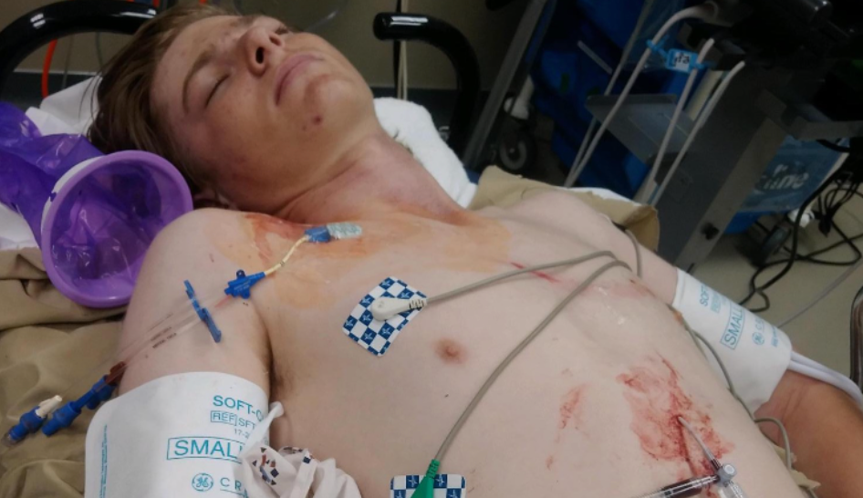 El pronóstico inicial de Dalton era desalentador y los doctores dijeron que podría no recuperase