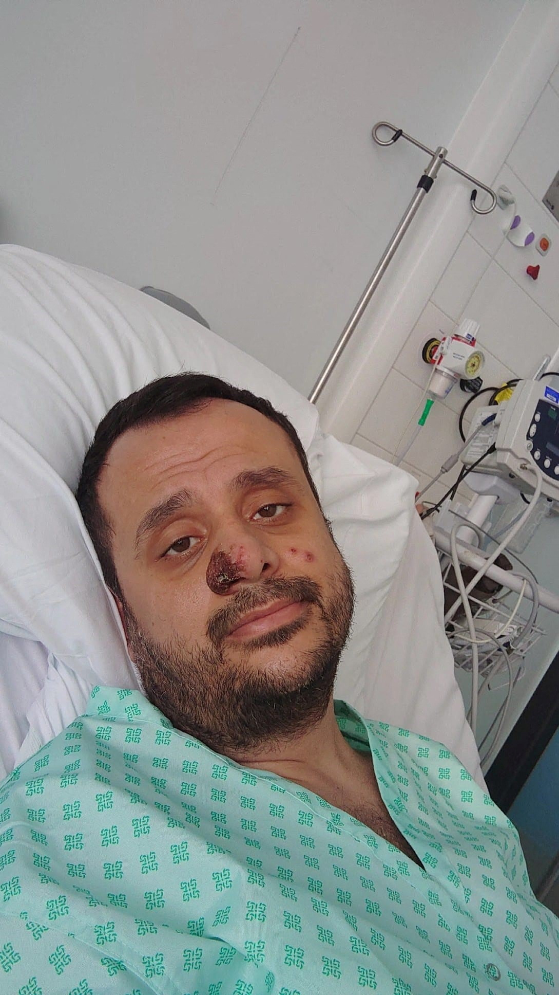 Harun Tulunay tuvo que ser hospitalizado en Londres por infección de viruela símica / Reuters 