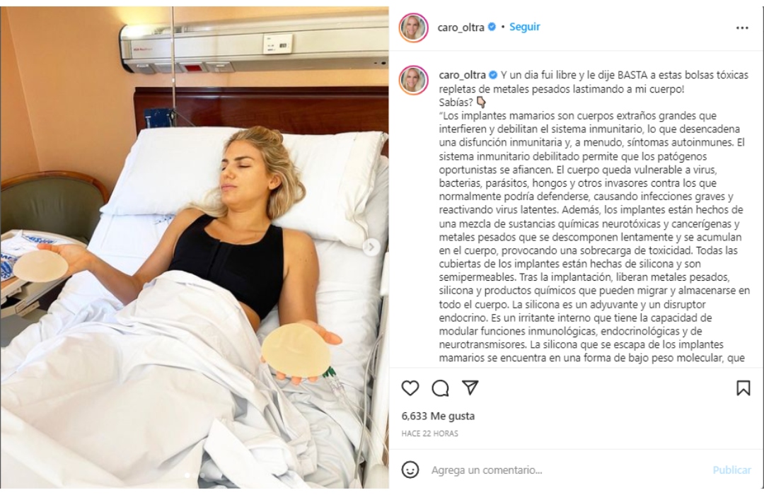 El posteo de Carolina Oltra tras sacarse los implantes mamarios
