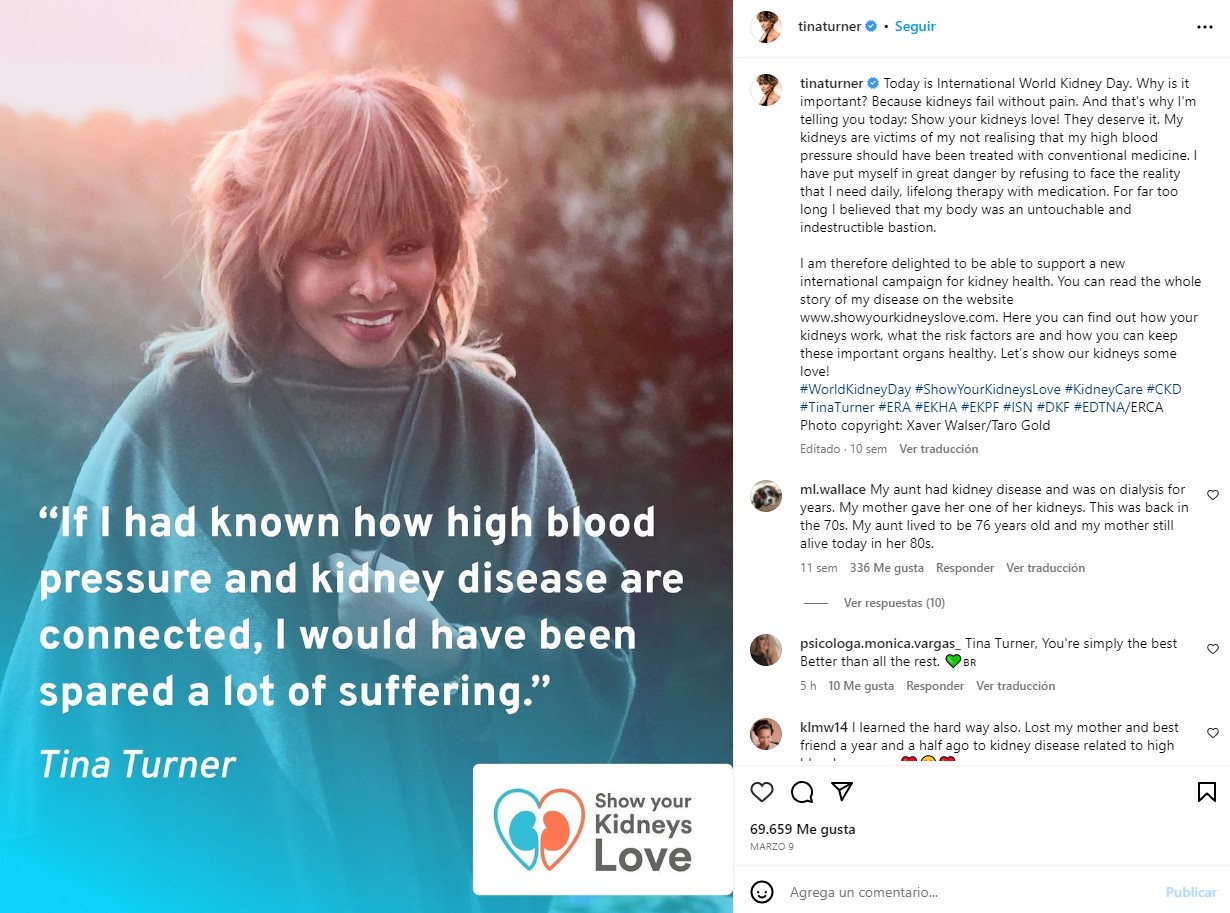 "Me he puesto en grave peligro al negarme a afrontar la realidad de que necesito un tratamiento diario y de por vida con medicación", escribió Tina Turner en sus redes sociales el pasado 14 de marzo
Foto: Instagram/tinaturner