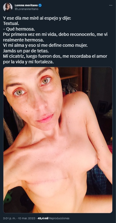 Lorena Meritano respondió a los comentarios de Carolina Cruz sobre la explantación mamaria subiendo a sus redes sociales una imagen de la que ella tuvo que realizarse en medio de su lucha contra el cáncer de seno (@LorenaMeritano/Twitter)