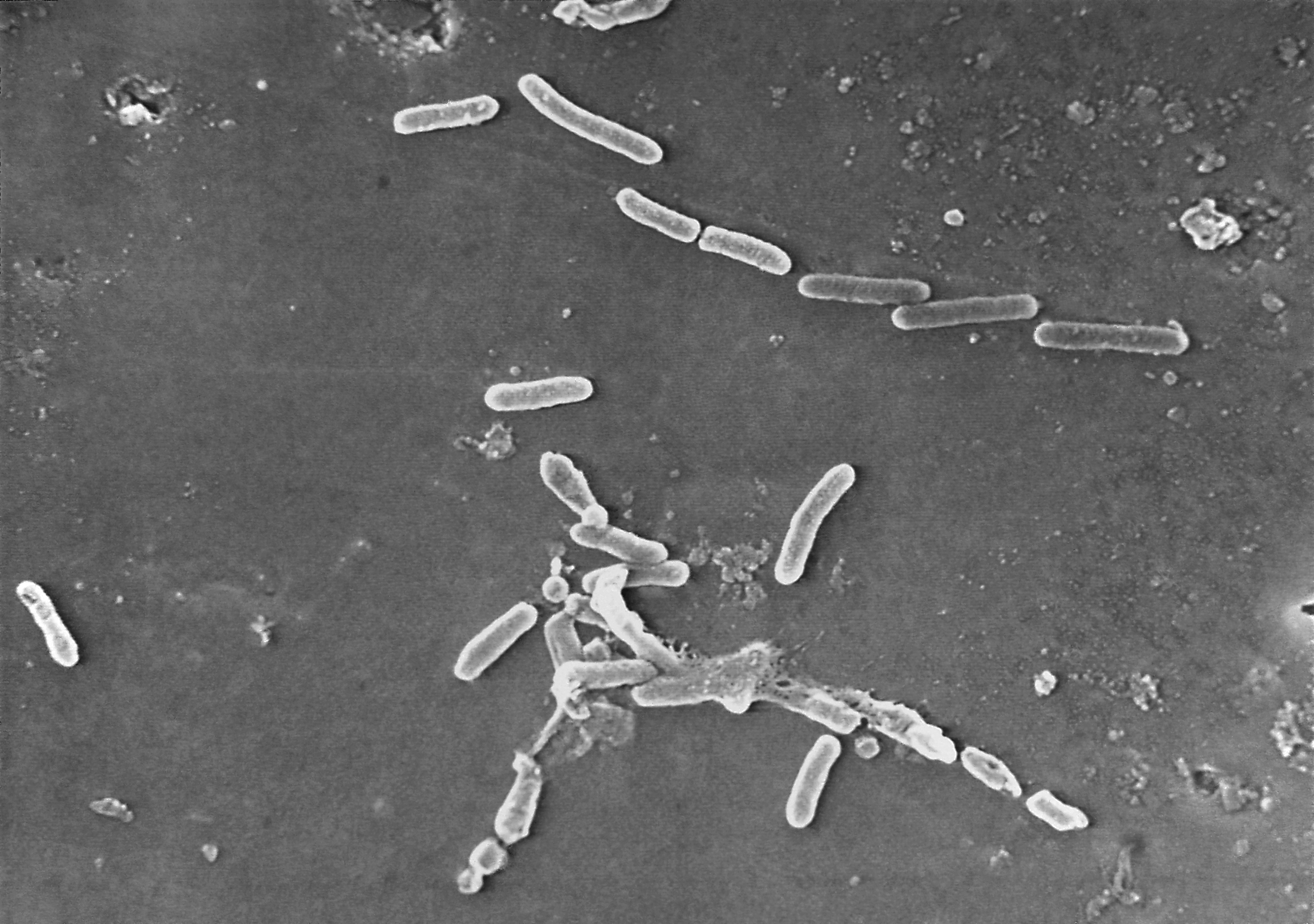 La bacteria Pseudomonas aeruginosa es resistente a los antibióticos y puede producir problemas en la córnea en muy poco tiempo (Janice Haney Carr/CDC vía AP, Archivo)