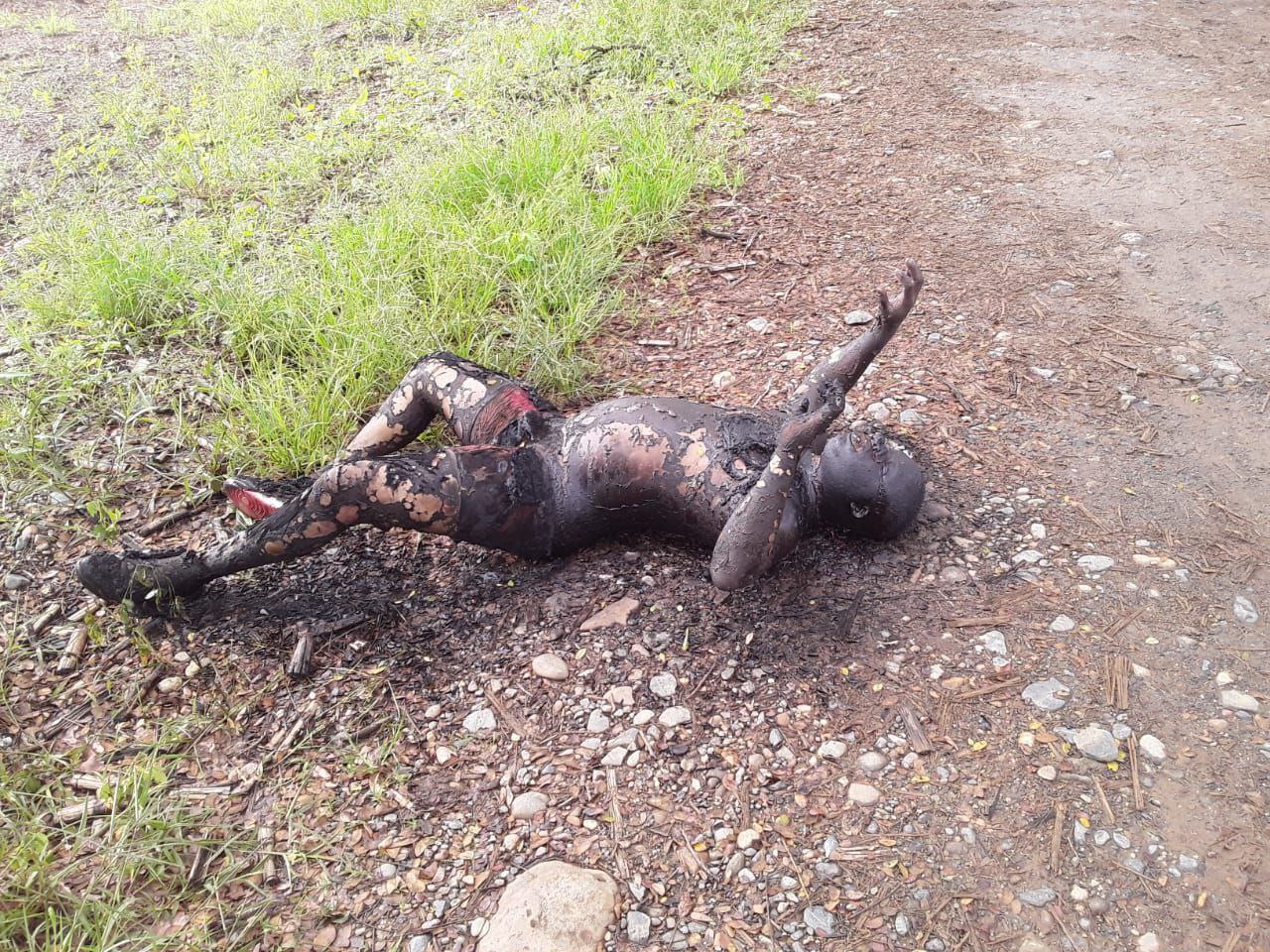 Burned person in Jamundí