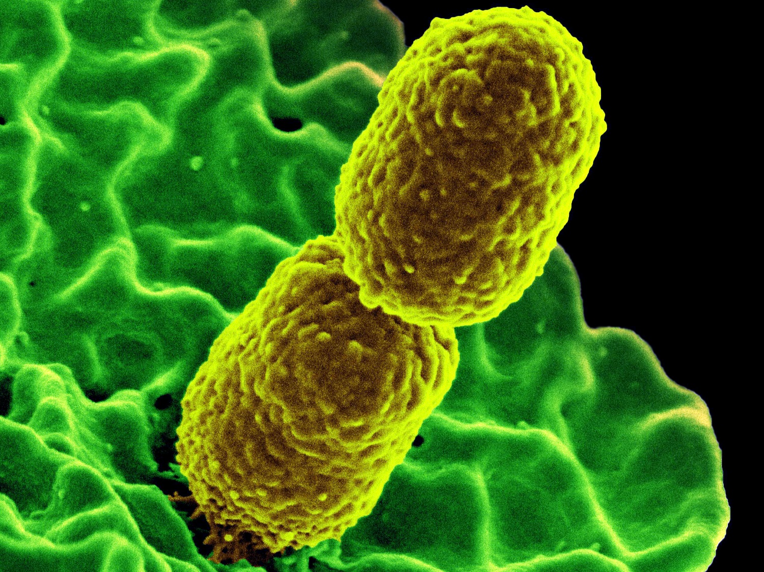 El desarrollo de nuevos antibióticos puede llevar más de 10 años/
National Institute of Allergy and Infectious Diseases (NIAID)