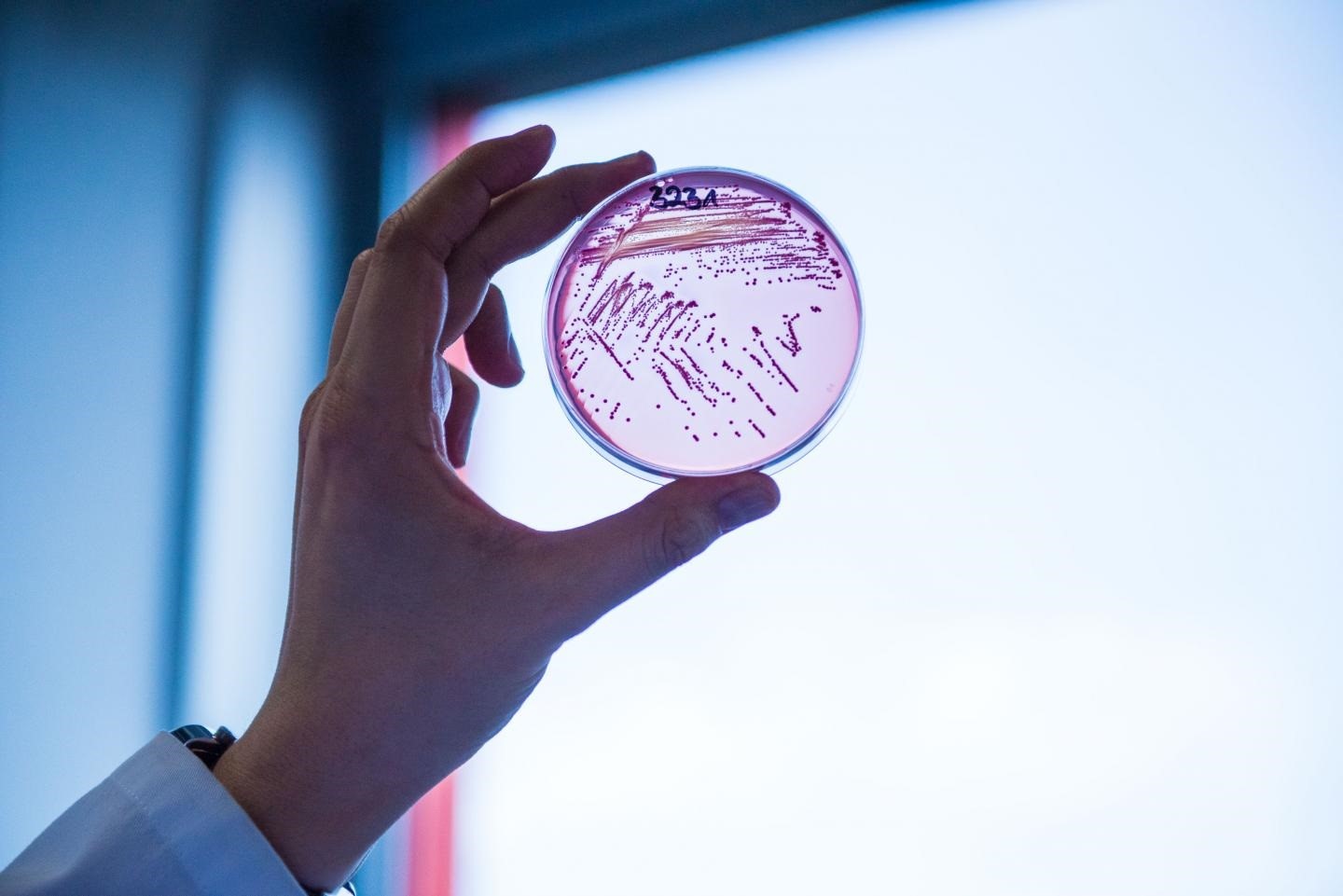 La posibilidad de compartir una superbacteria entre personas y animales es un descubrimiento relativamente nuevo (Europa Press)