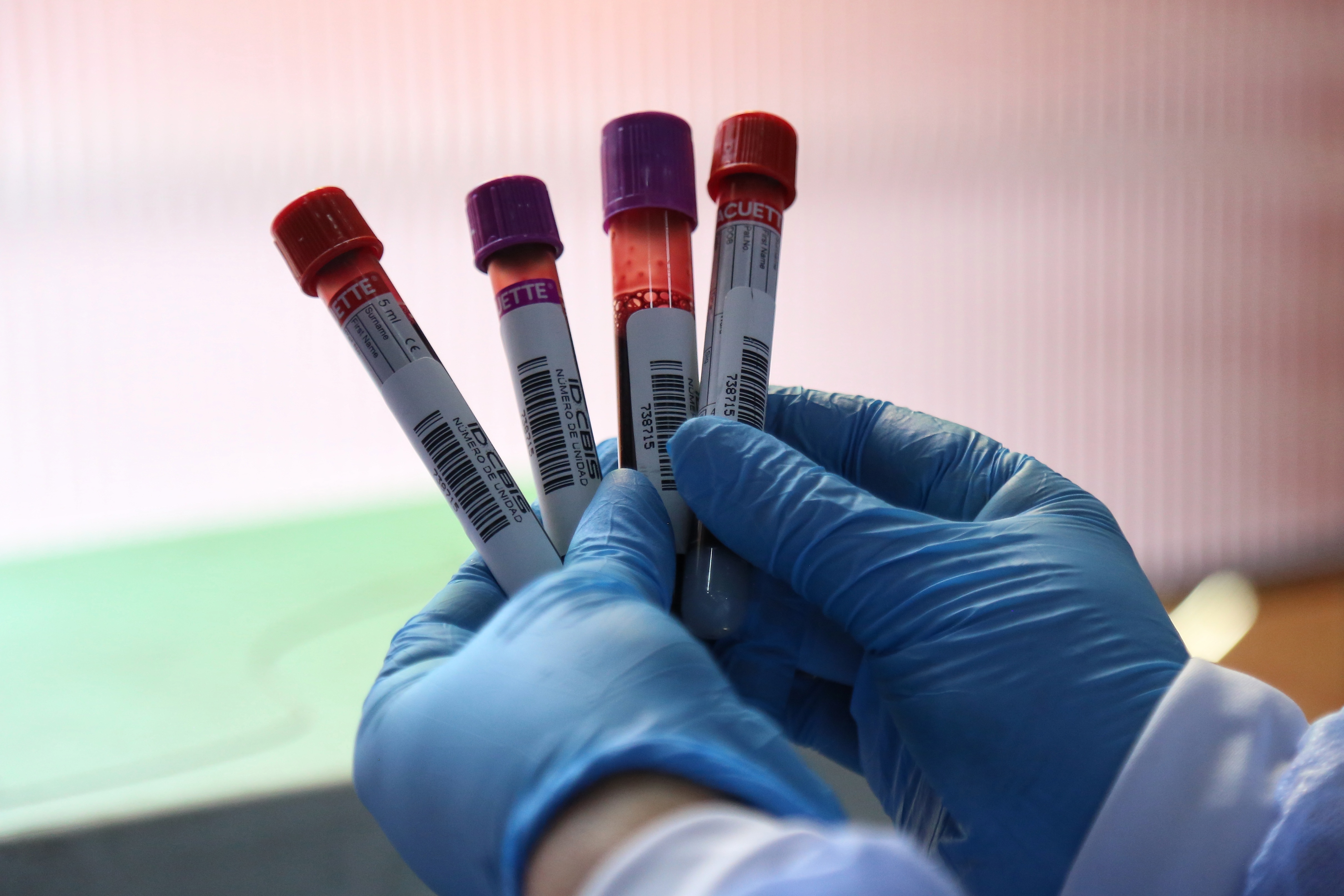 Plano Cuestiones diplomáticas Municipios Sangre cultivada en laboratorio: por primera vez dos pacientes recibieron  material sanguíneo artificial - Infobae