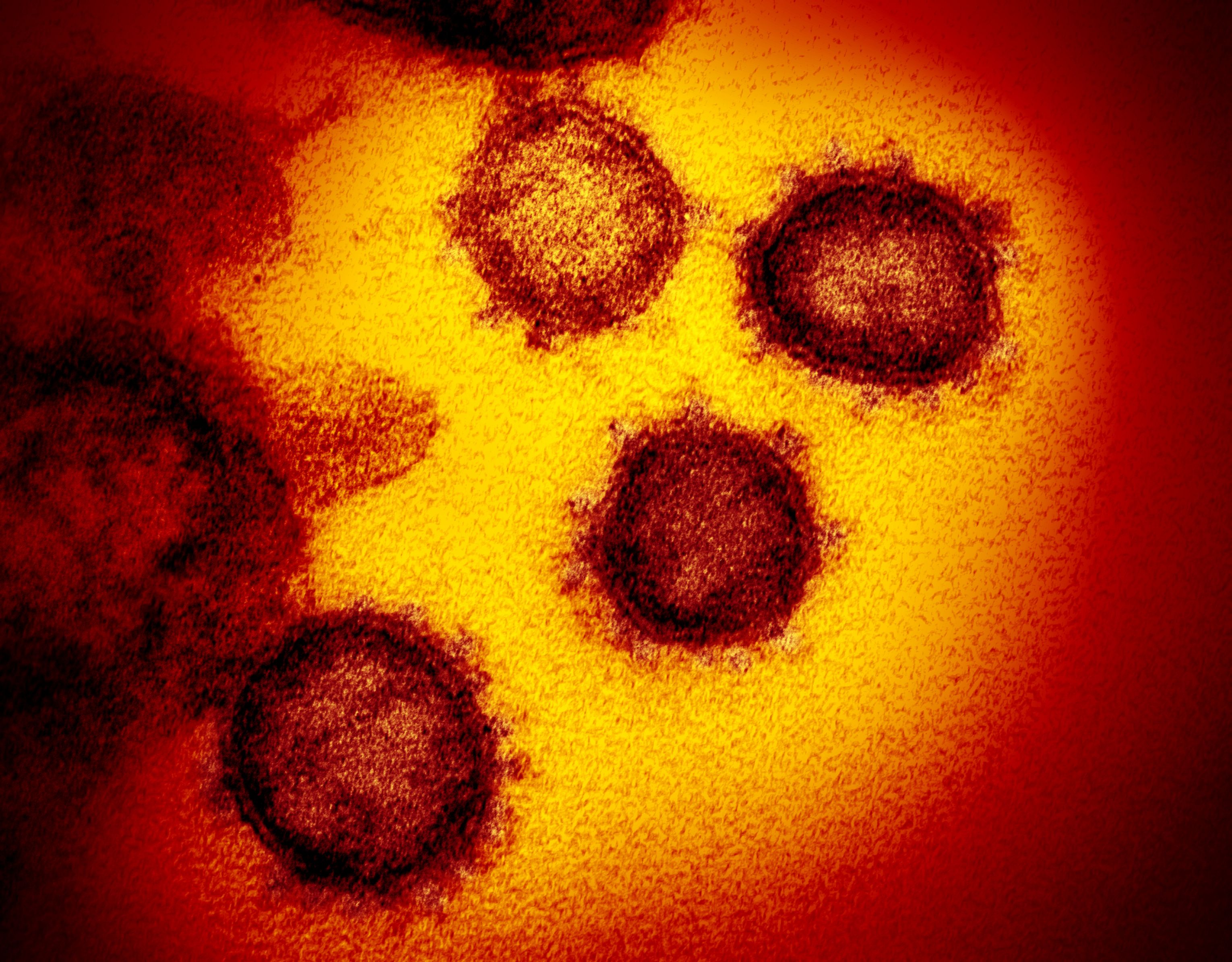 El coronavirus SARS-CoV-2 está mutando en nuevas cepas más contagiosas y mortales - REUTERS. 