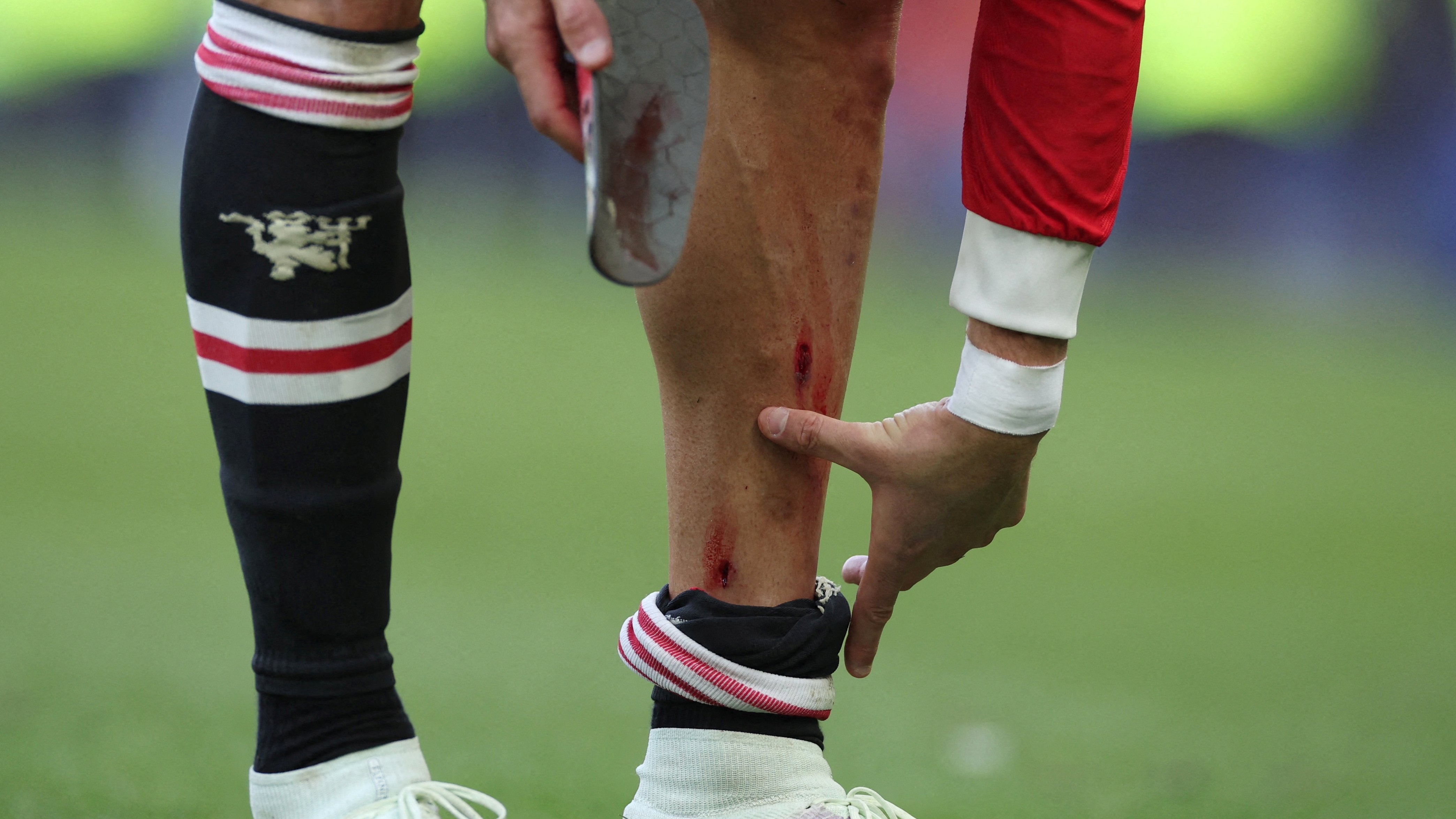 Ronaldo tenía una herida en la pierna al término del partido contra el Everton (Reuters)