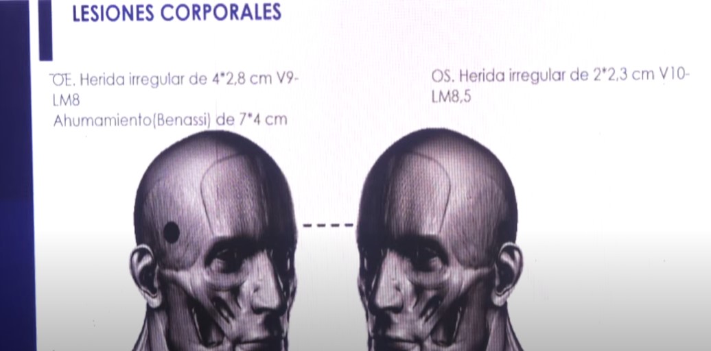 Representación del cráneo de Óscar Dávila que Medicina Legal presentó para confirmar su suicidio. Captura de pantalla.