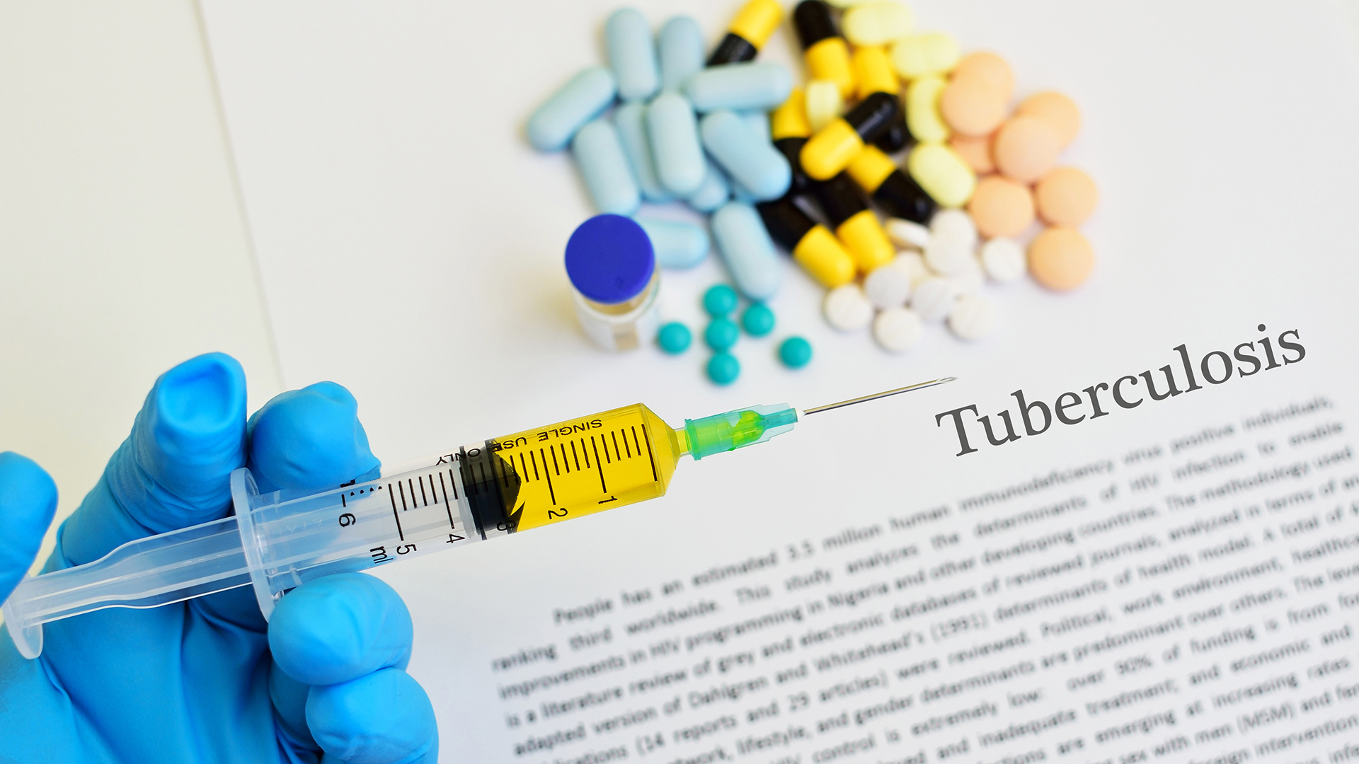 Los casos potencialmente perdidos o retrasados favorecerían la propagación del bacilo que causa la tuberculosis/Archivo