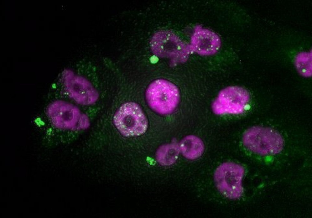 27/02/2020 Células tumorales de adenocarcinoma de páncreas que muestran signos de daño en el ADN del núcleo (puntos blancos) y de micronúcleos (en verde), después de un tratamiento con taxol seguido de inhibidores de CDK4/6
SALUD 
CNIO
