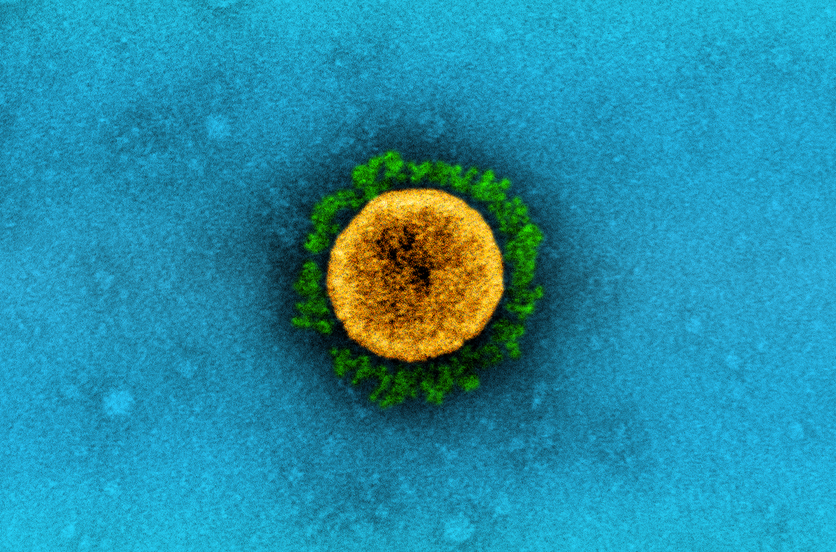 El SARS-CoV-2 que genera la enfermedad COVID-19 es observado bajo microscopio (Getty Images)