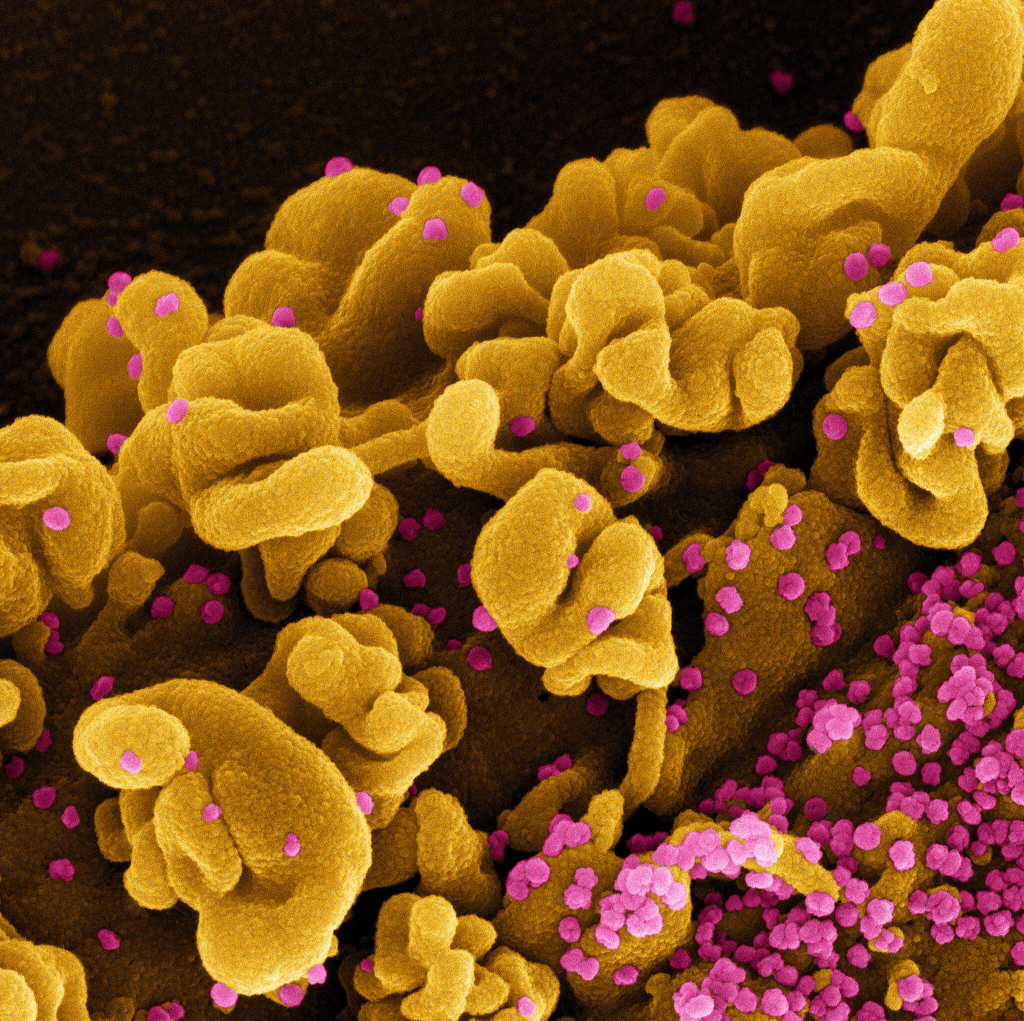 Colorized scanning electron micrograph of a cell infected with the Omicron strain of SARS-CoV-2 virus particles (pink), isolated from a patient sample. Image captured at the NIAID Integrated Research Facility (IRF) in Fort Detrick, Maryland.

CREDIT
NIAID