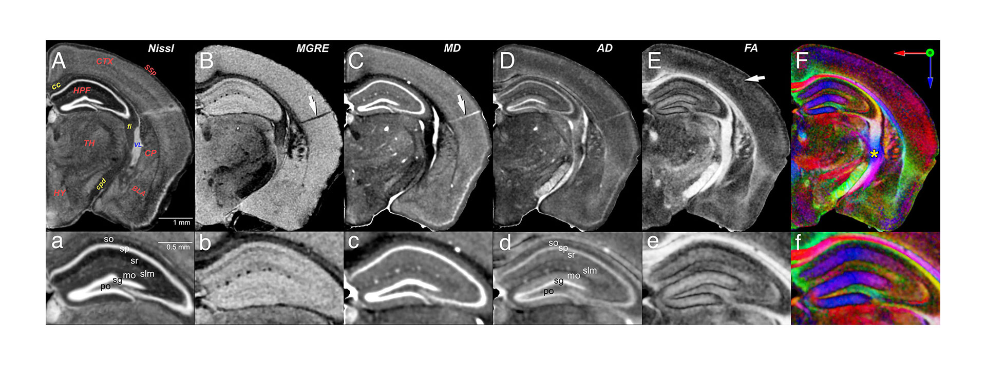 La figura muestra una descripción general del contraste MRH en el cerebro de los ratones hallado en la nueva investigación (G. Allan Johnson, Yuqi Tian, David G. Ashbrook y Robert W. Williams)
