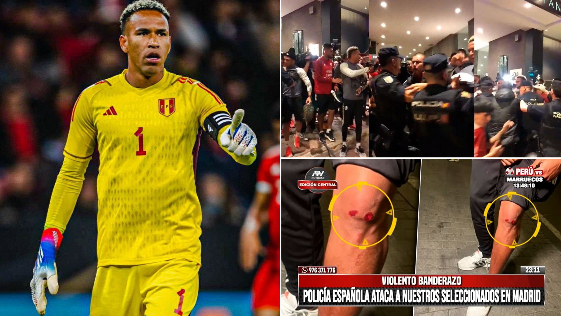 Pedro Gallese y jugadores de Perú agredidos por la policía en España: todo el escándalo que involucró a la ‘bicolor’
