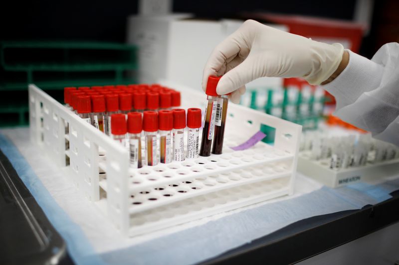 Los investigadores examinaron muestras de sangre de referencia de 2.540 participantes para determinar los niveles de antígeno del SARS-CoV-2. (REUTERS/Marco Bello)