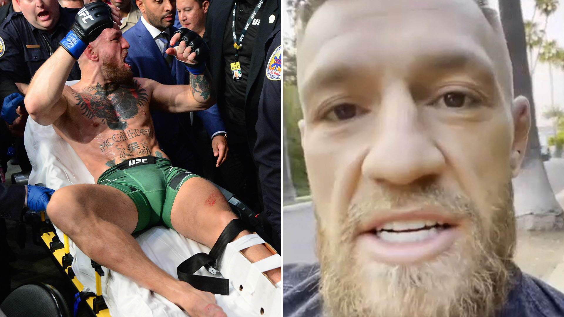 Conor McGregor rompió el silencio para contar su verdad sobre la espeluznante lesión que sufrió ante Poirier