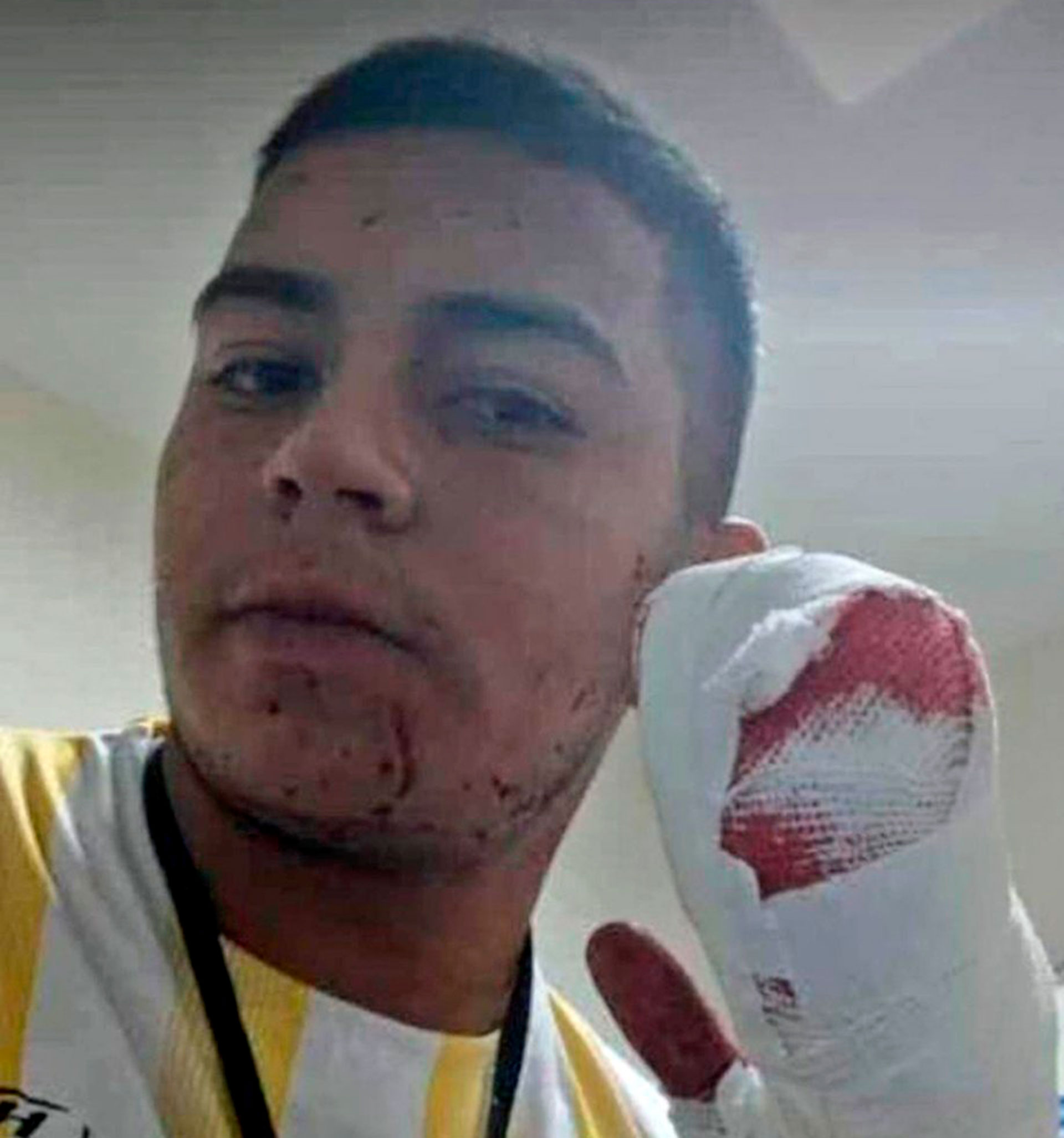 Martín Abraham, el joven al que le amputaron los dedos con un machete durante un asalto en San Miguel de Tucumán