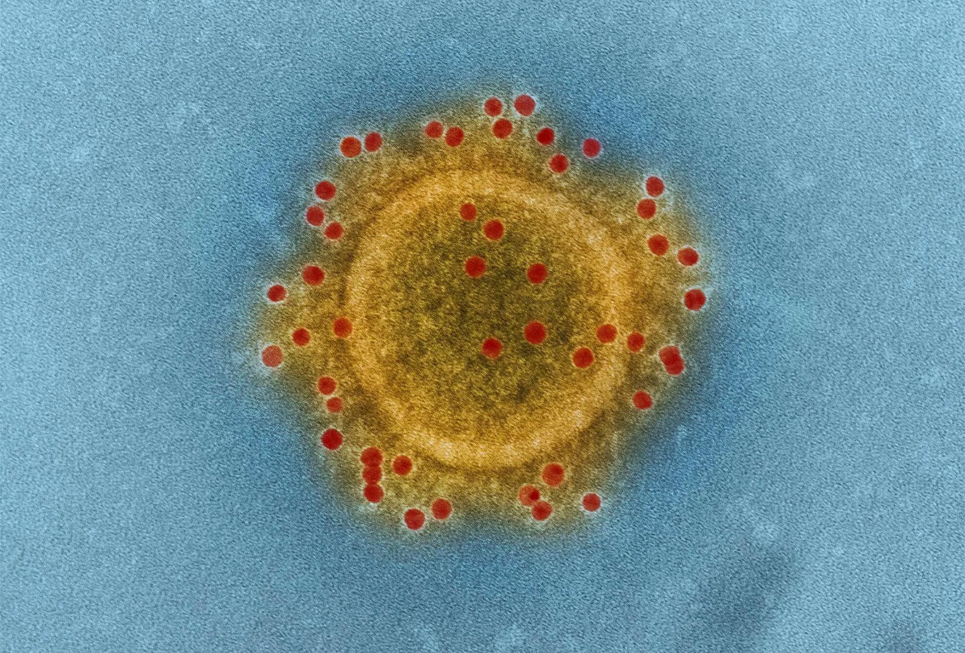 A MERS coronavirus particle.Credit...NIAID