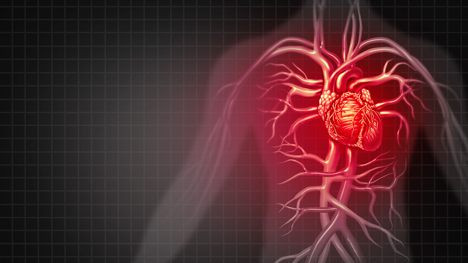 Heart attack and chest pain medical cardiovascular disease as an illness of a human circulation organ in a 3D illustration style.
