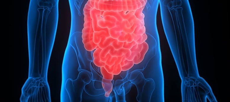 El gastroenterólogo Luis Caro: “El cáncer de colon provoca 23 muertes por día que pueden prevenirse”