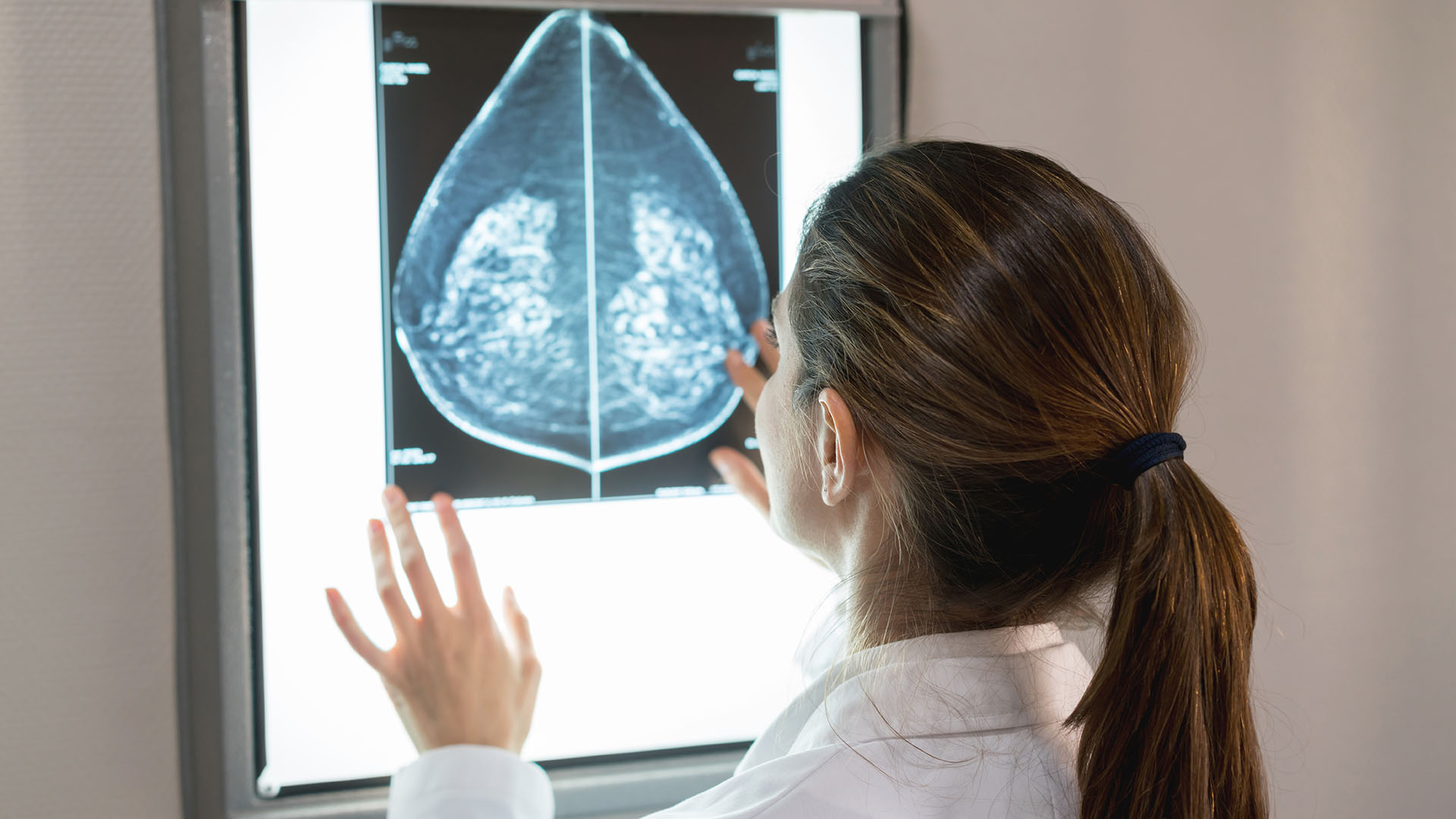 La mitad de los cánceres de mama se desarrollan en mujeres que no tienen un factor de riesgo de cáncer de mama identificable aparte del sexo (mujeres) y la edad (mayores de 40 años) (Getty)
