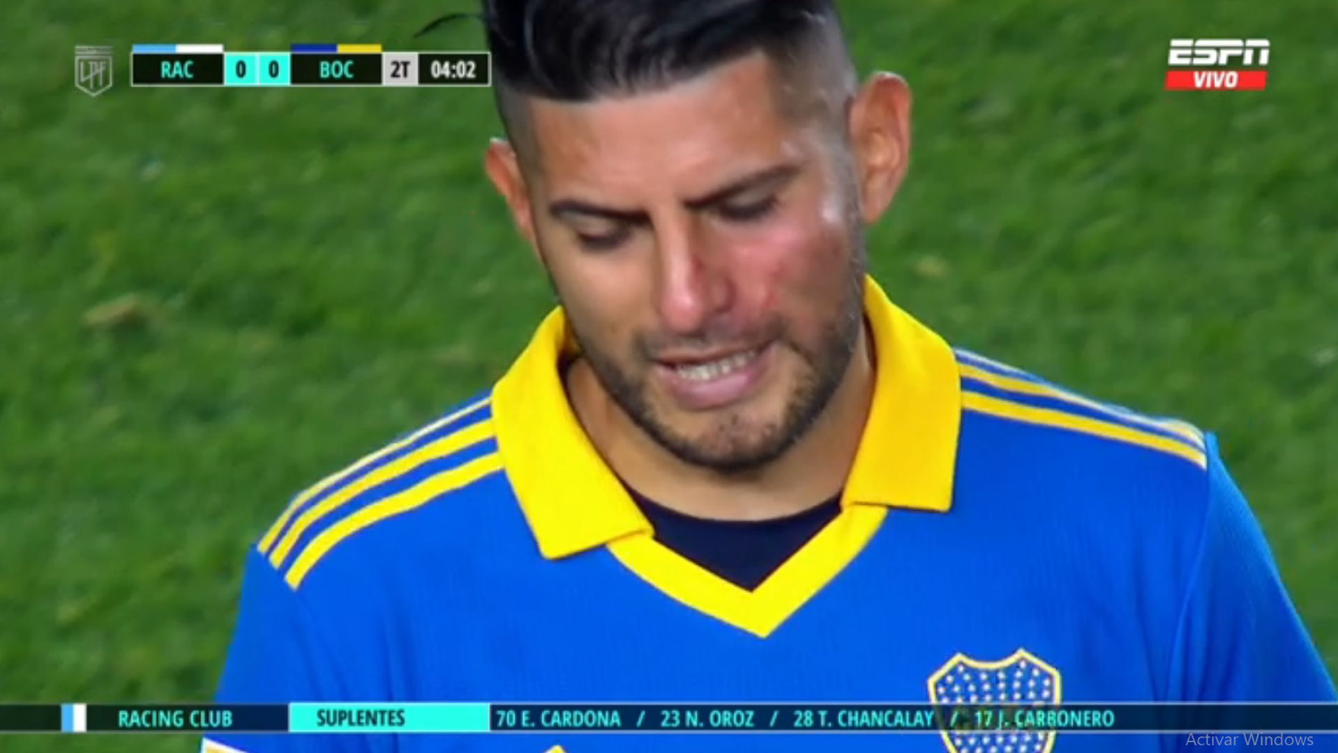 Carlos Zambrano apareció con el rostro marcado en Boca Juniors: ¿se peleó con Darío Benedetto?