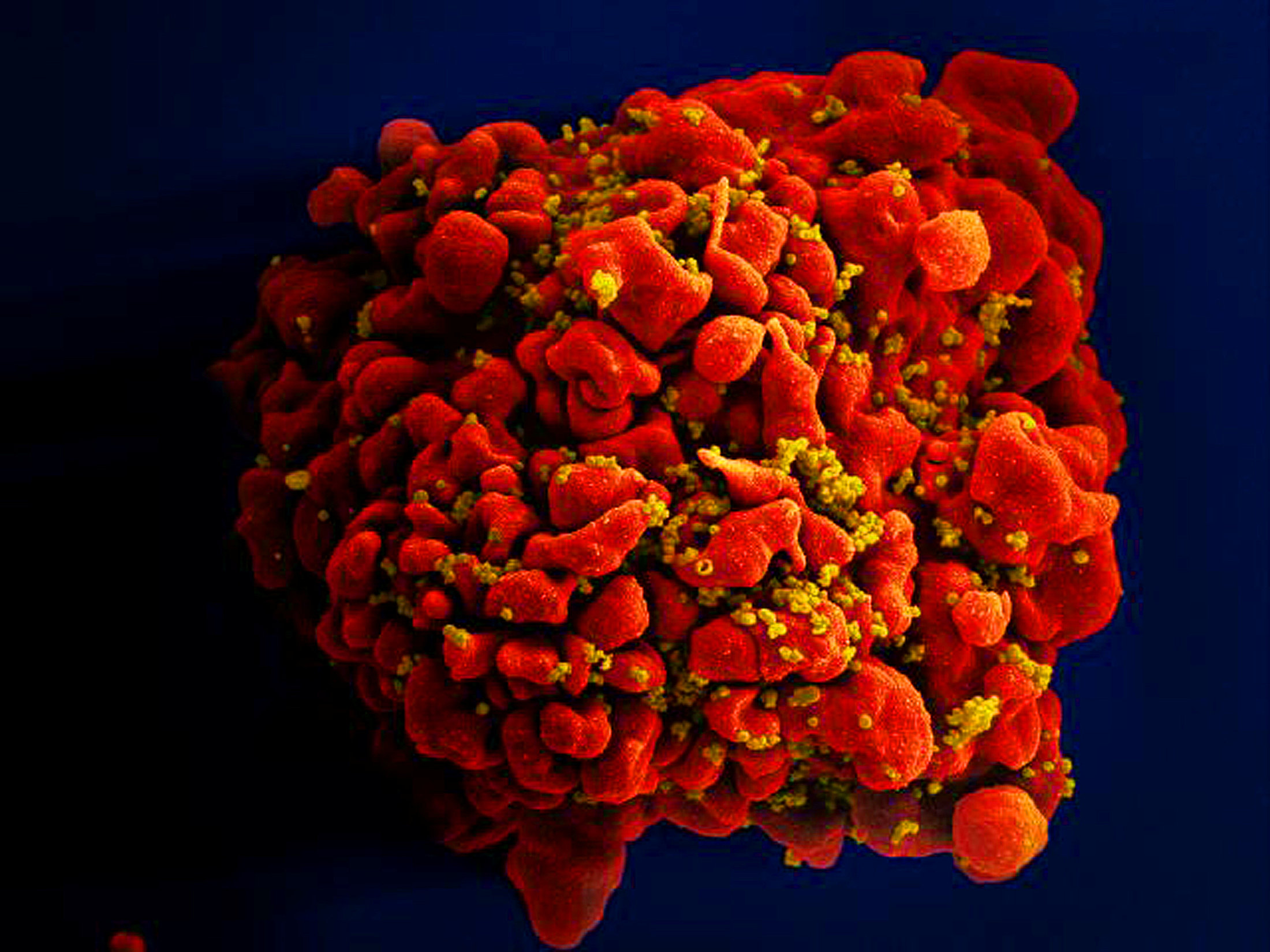 En rojo, la célula T es vista bajo el microscopio electrónico - Courtesy National Institute of Allergy and Infectious Diseases (NIAID)/Handout via REUTERS 