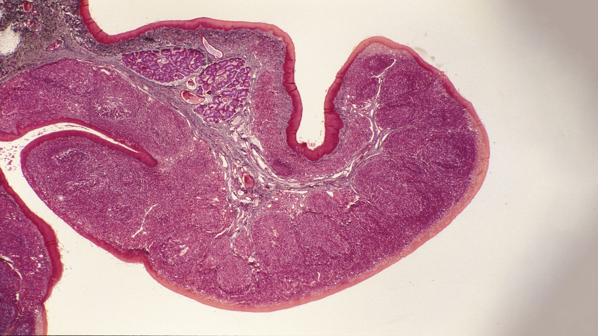 A partir de los 3 años las amígdalas palatinas pueden alojar infecciones bacterianas como, por ejemplo, el estreptococo betahemolítico (Getty Images)