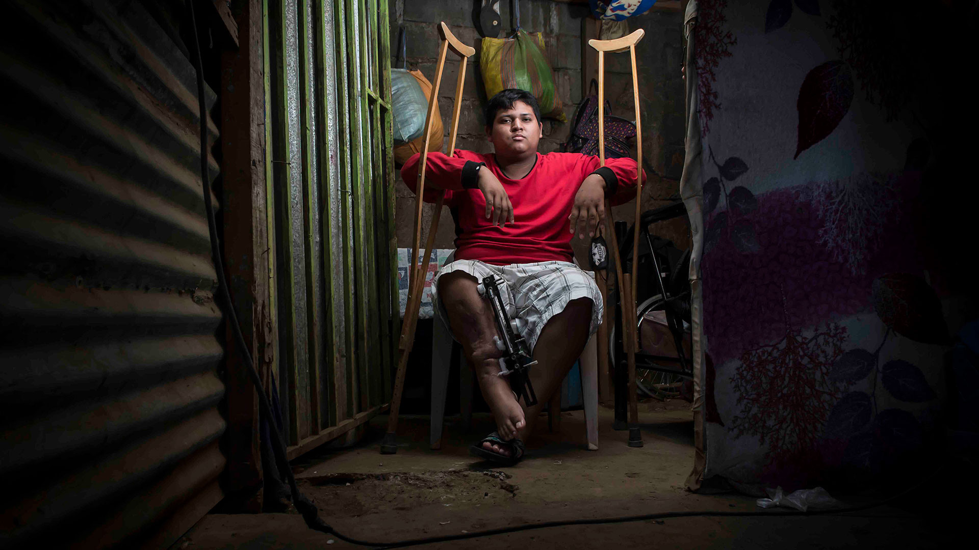 Isaac Ramírez tenía 17 años cuando recibió el impacto de una escopeta en su pierna. Hoy tiene 21. Foto: Óscar Navarrete
