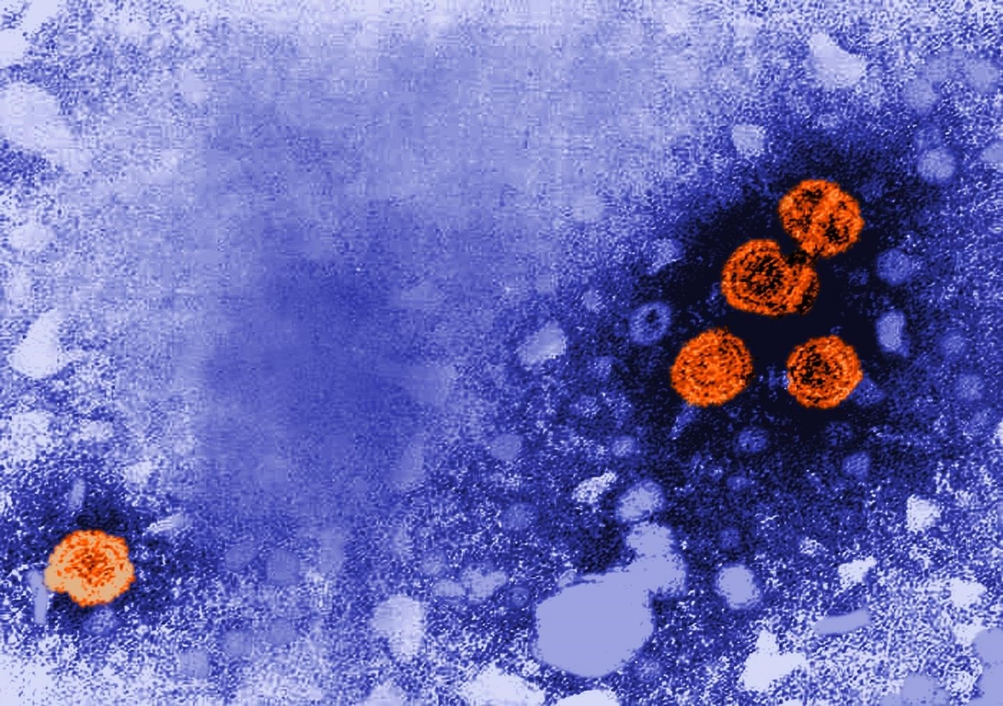 Imagen de microscopía electrónica de transmisión coloreada digitalmente revela la presencia de viriones de la hepatitis B (de color naranja). (CDC/DR. ERSKINE PALMER)
