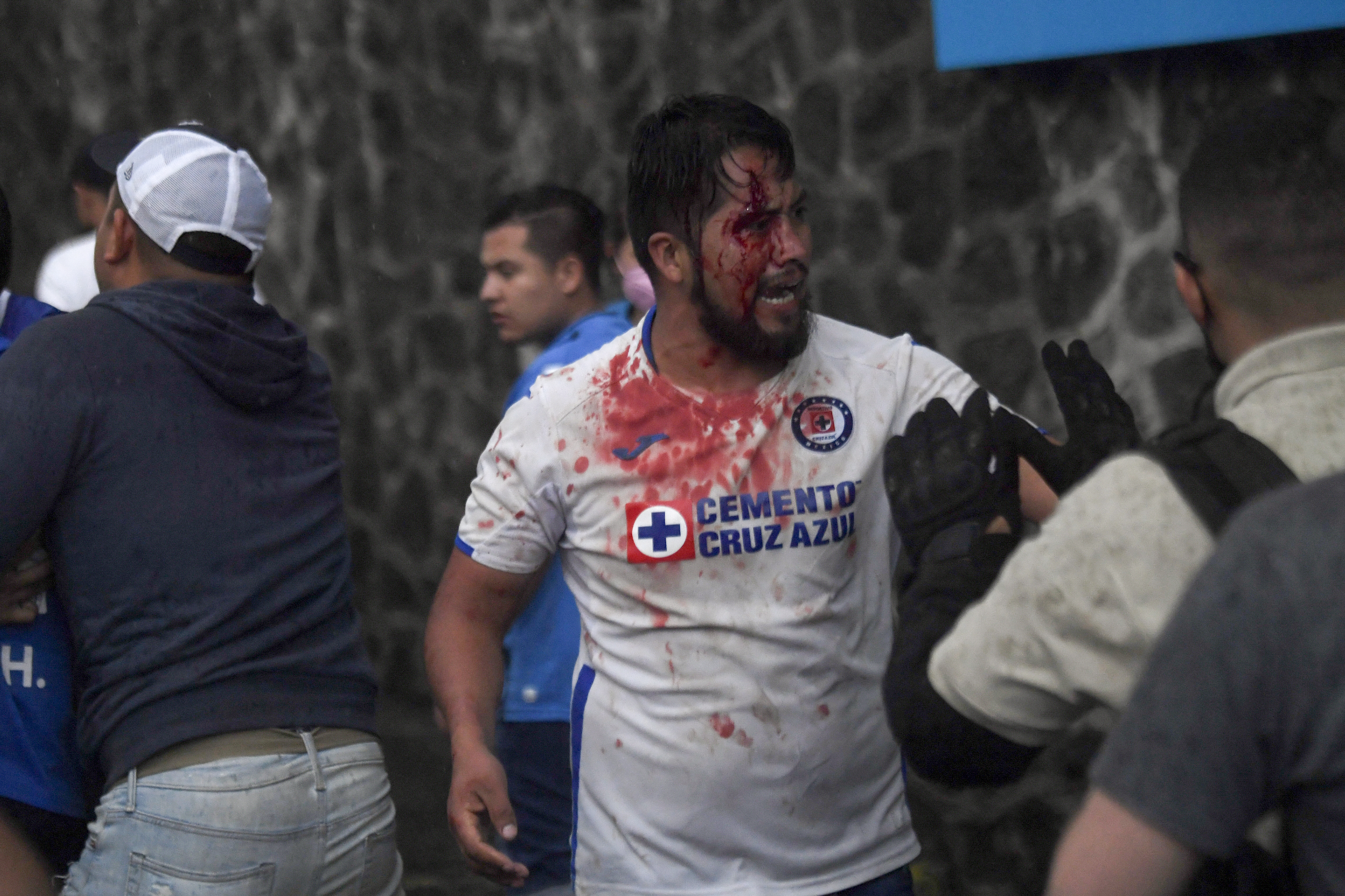 Un hombre fue golpeado y apareció lleno de sangre en fotografías y videos (Foto: PEDRO PARDO / AFP)