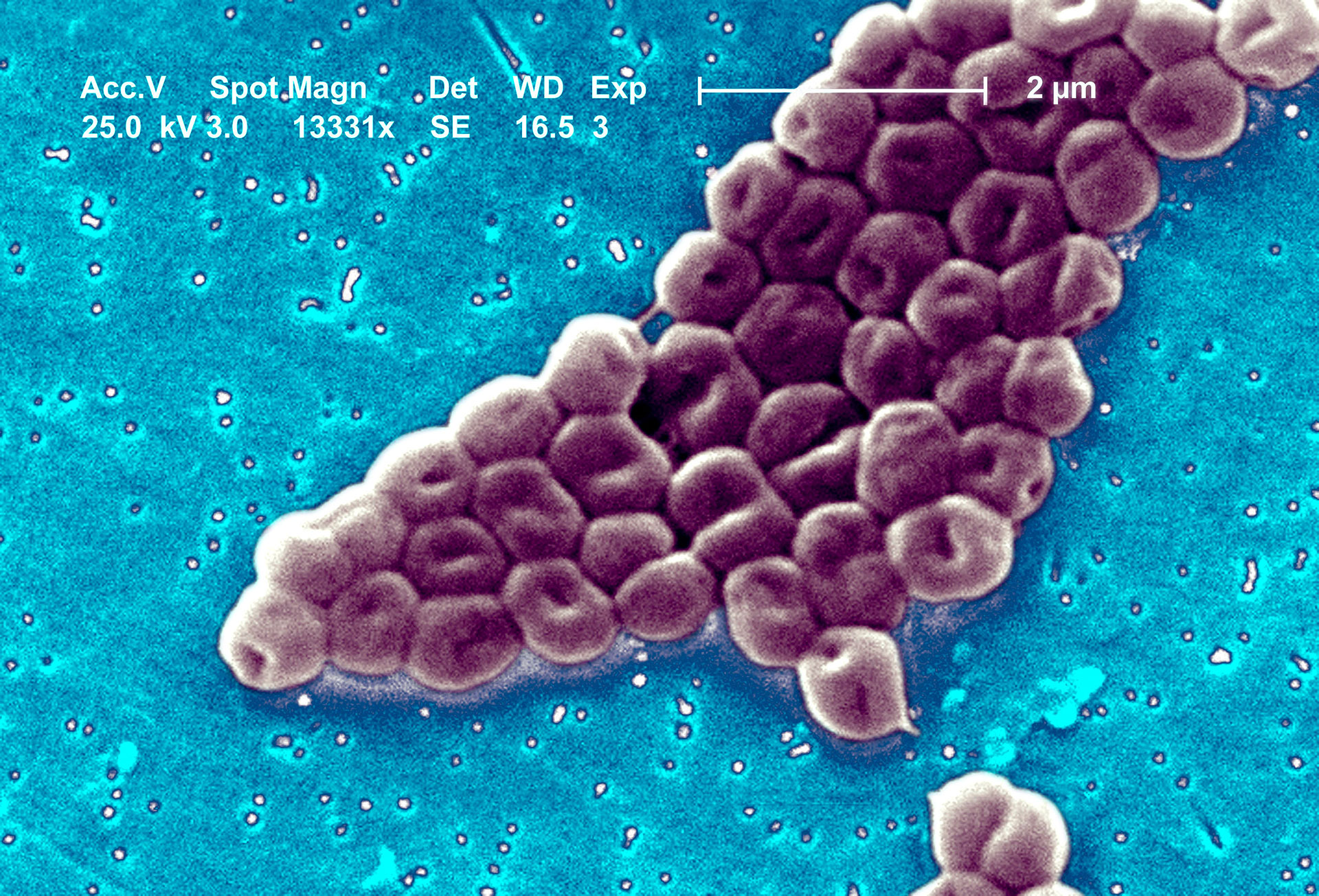 La Acinetobacter baumannii causa neumonía, sepsis e infecciones en heridas (Grosbygroup)
