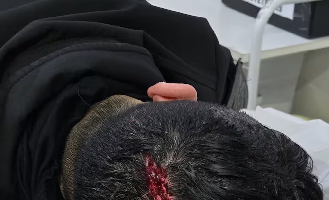Escaparon de un control, se escondieron en una casa y agredieron a la Polic&iacute;a: hay tres detenidos