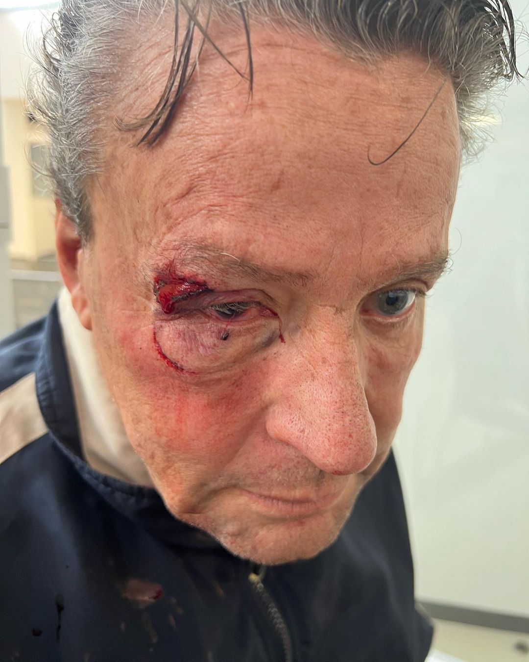 El actor fue golpeado en medio de la movilización generada por el asesinato de una persona -al parecer un policía- "a 30 metros de su casa" (Foto: IG @adamereacciona)