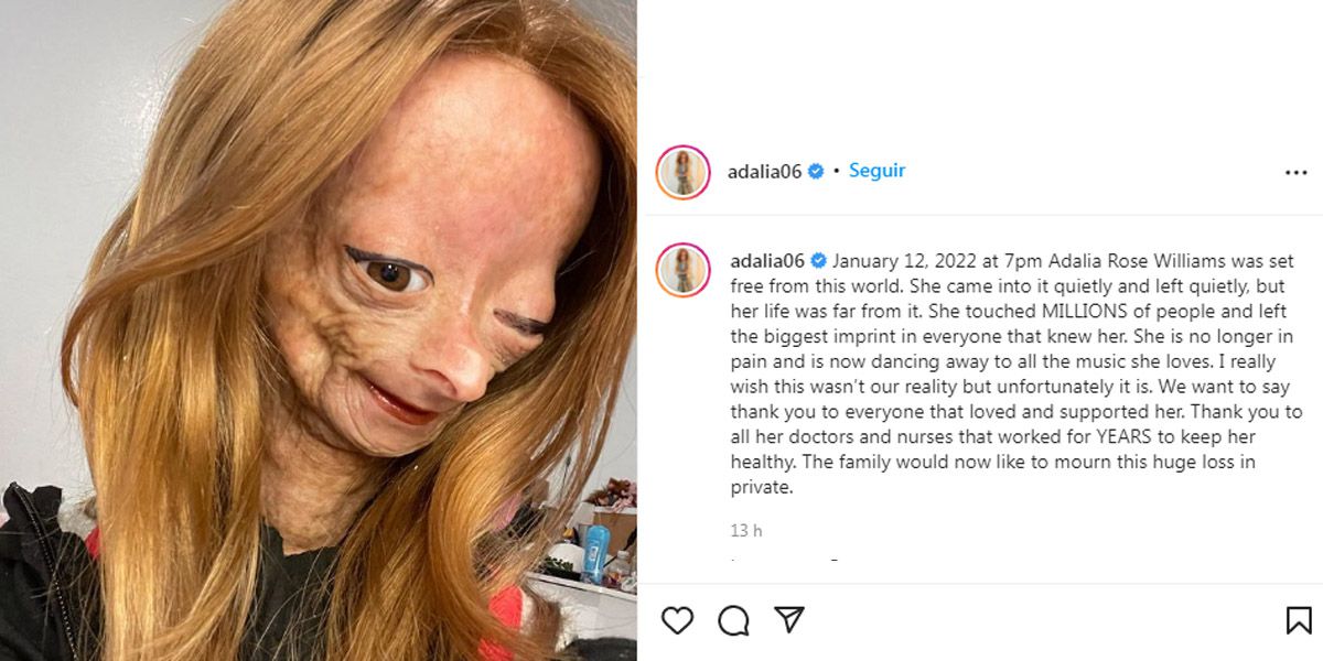 Comunicado del fallecimiento de Adalia Rose en Instagram. Foto: difusión.