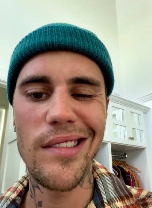 Justin mostró que, al intentar sonreír o cerrar su párpado, los músculos de su cara no reaccionan (Foto: captura de pantalla/Instagram)