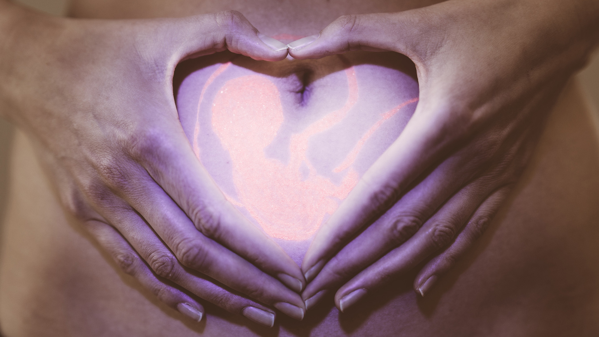 “un Corazón Distinto” Cómo Es La Cirugía Cardíaca Fetal Que Salva La 4951