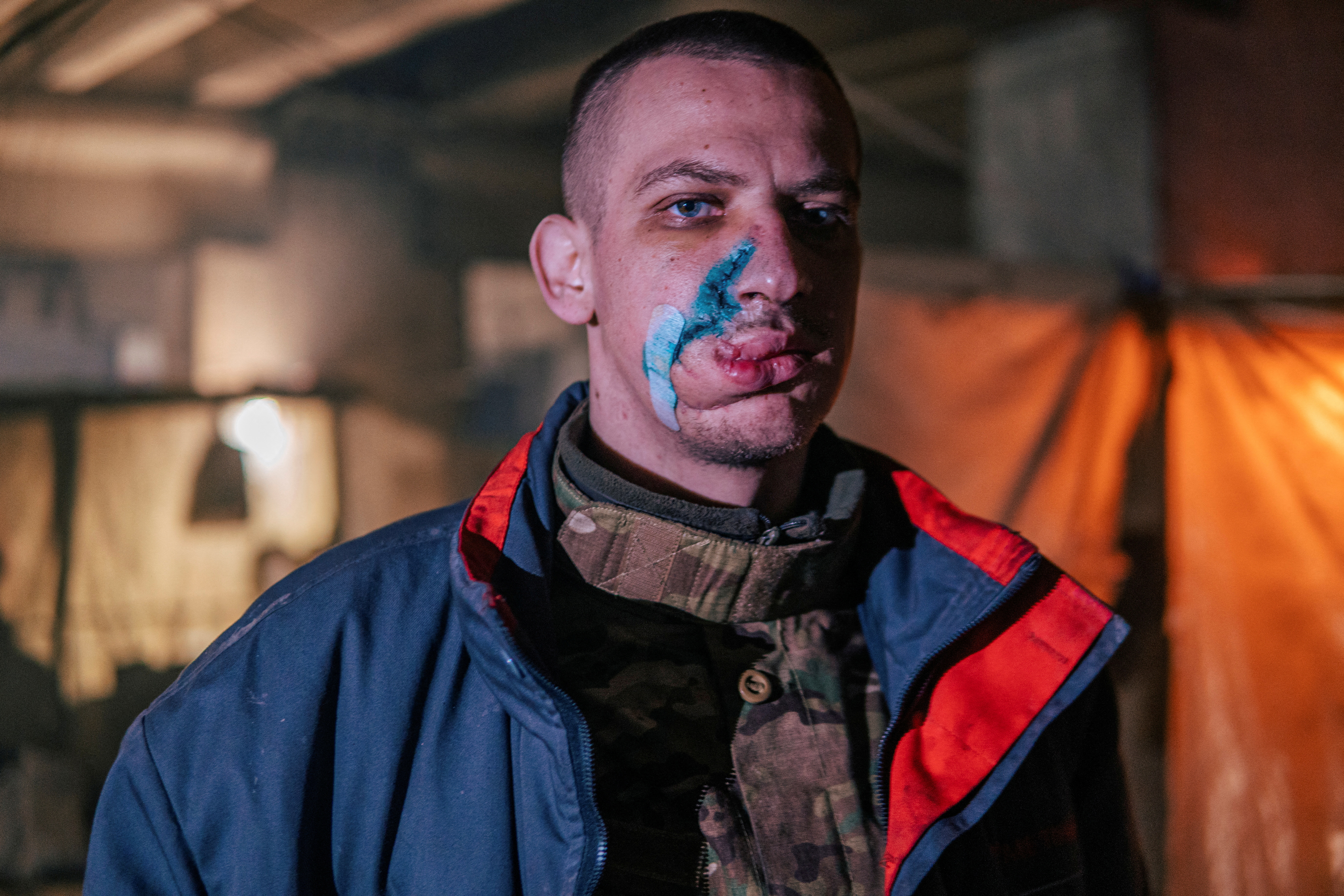 El rostro de competete ucraniano muestra las brutales marcas de sus heridas 