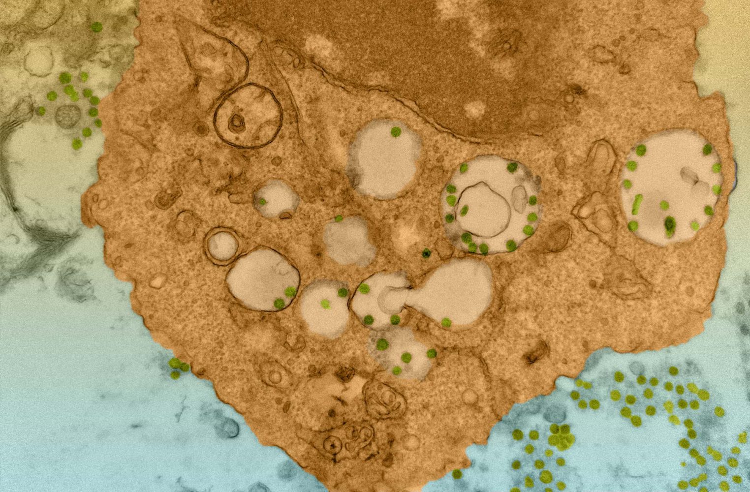 Una imagen de las partículas del coronavirus en una célula macrófago dentro del modelo con tejido humano que produjeron en Estados Unidos (Florian Douam, Devin Kenney en colaboración con Harvard Medical School / Electron Microscopy Facility)