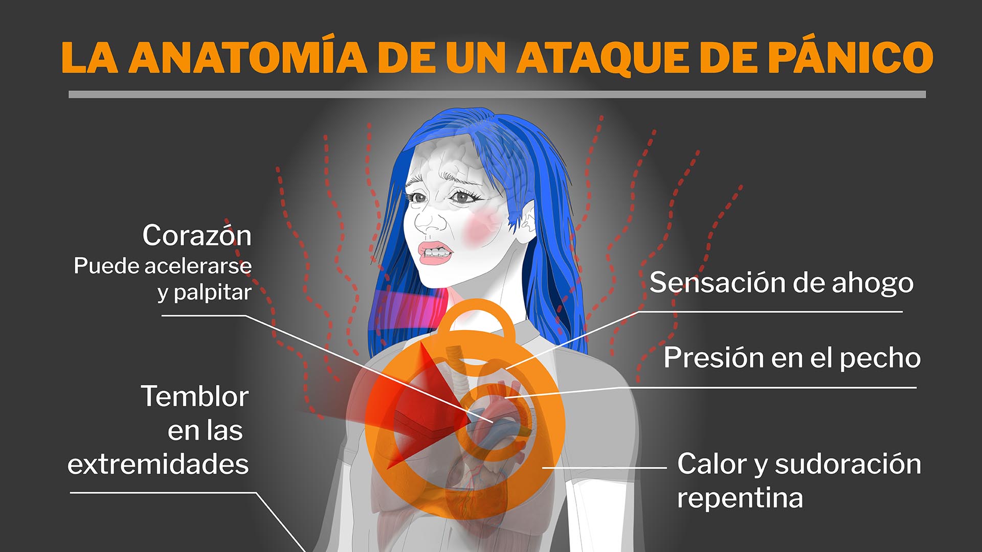 Infografia Anatomía de un ataque de pánico / Marcelo Regalado