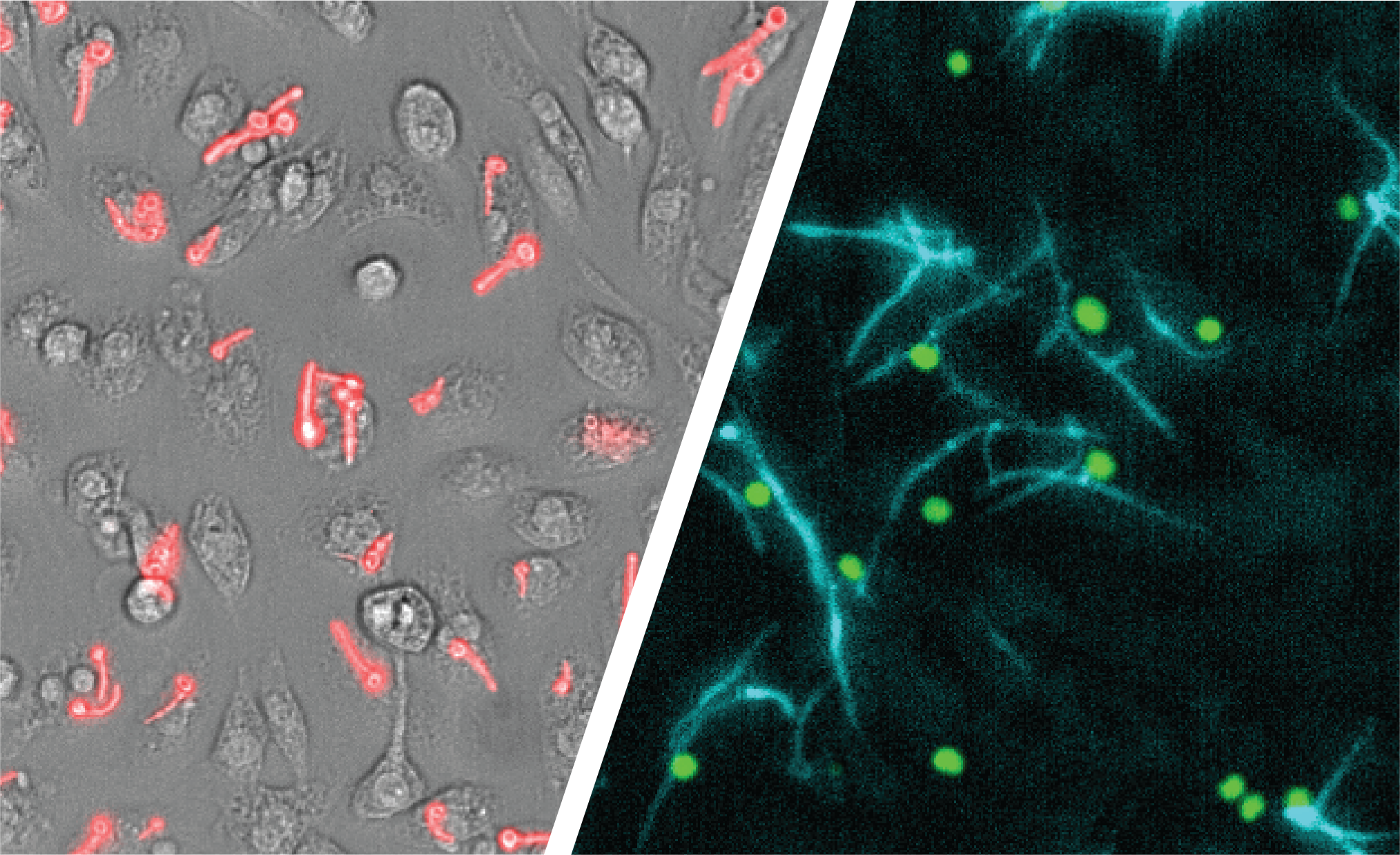 El Candida albicans, uno de los hongos patógenos más comunes a nivel mundial, apareció en 2009 y los expertos advierten que tiene un alto potencial de provocar brotes / Monash University