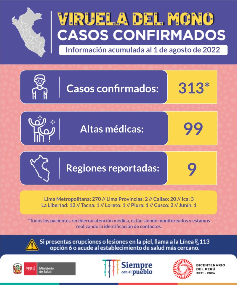 Minsa informa sobre los casos de Viruela del Mono en el Perú