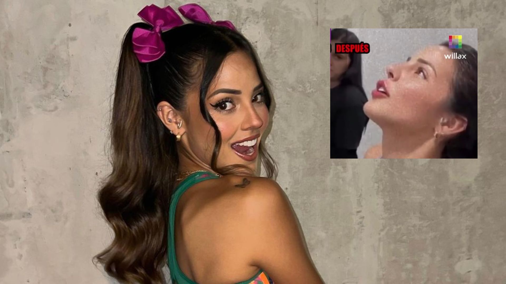 Luciana Fuster se hizo retoque estético en los labios para su participación en el ‘Miss Grand Perú', según ‘Amor y Fuego’